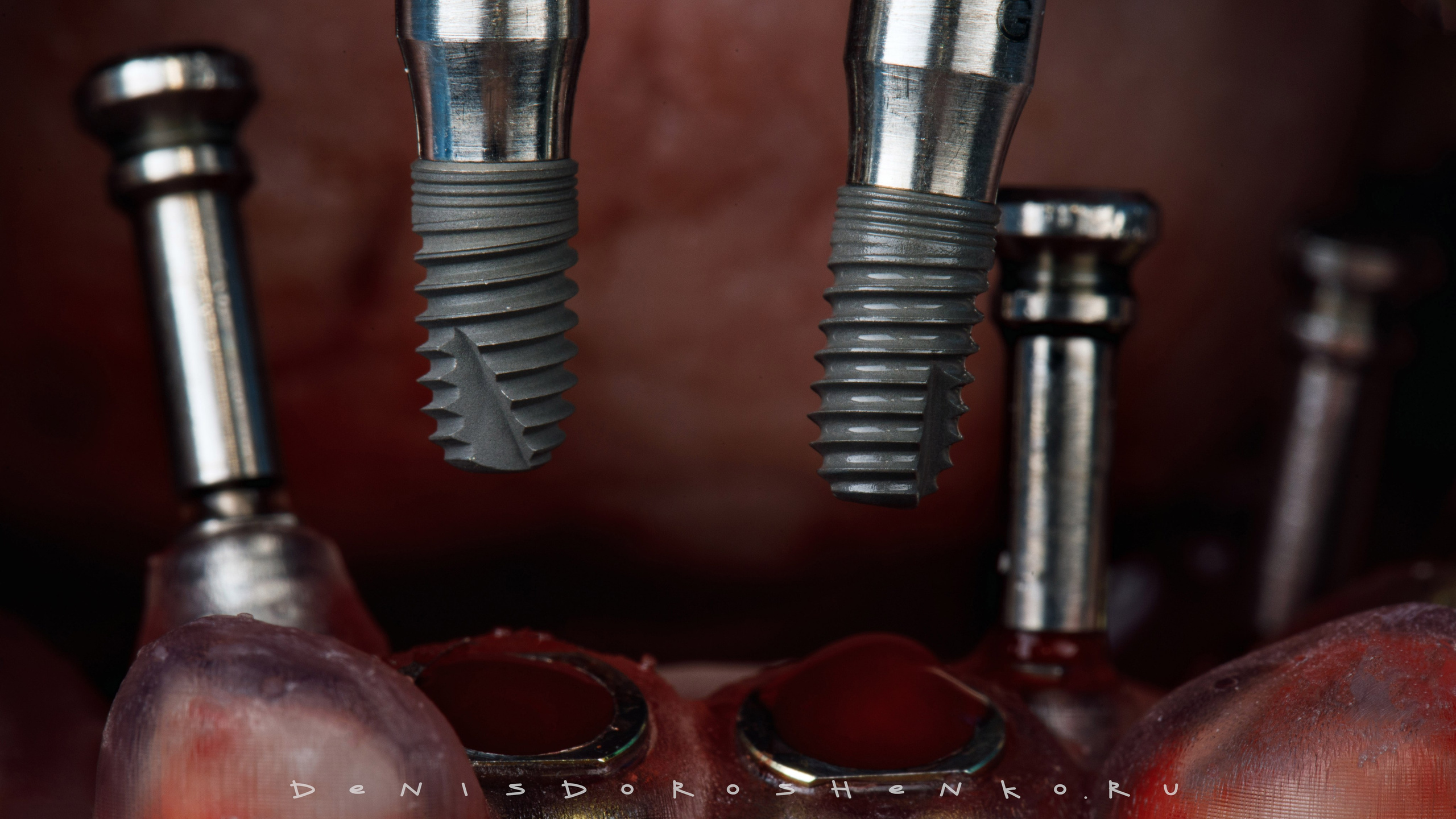 Хирургия. Дентал фотограф — видеограф Денис Дорошенко