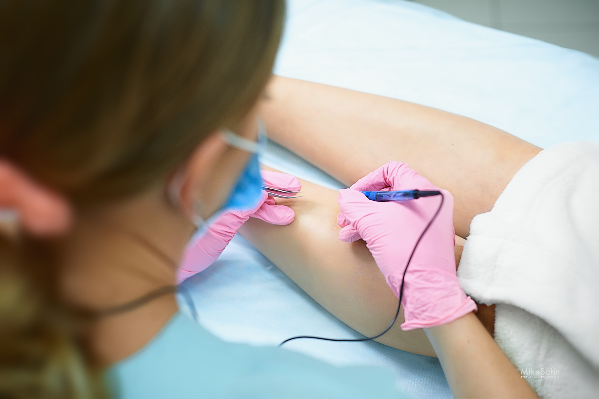 Электроэпиляция фотографии для постов, рекламы, бизнеса