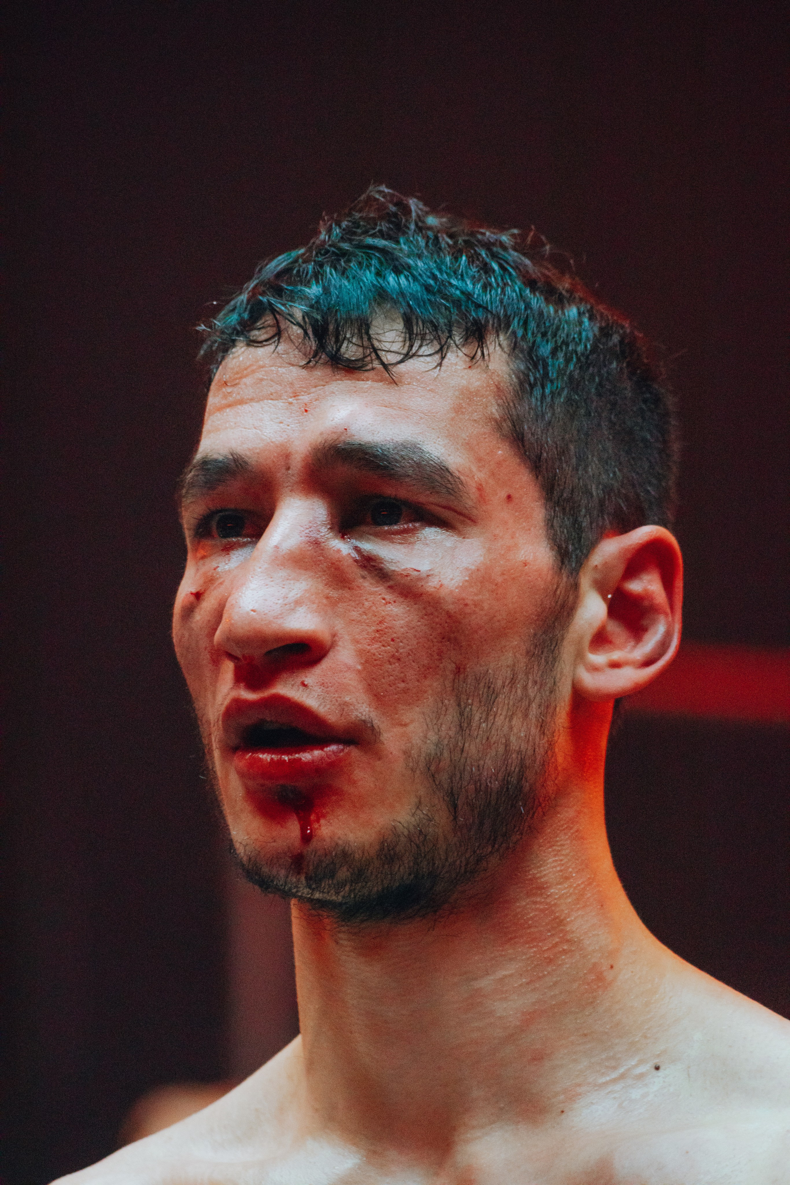 Кулачные бои TopDog. Анастасия Тен