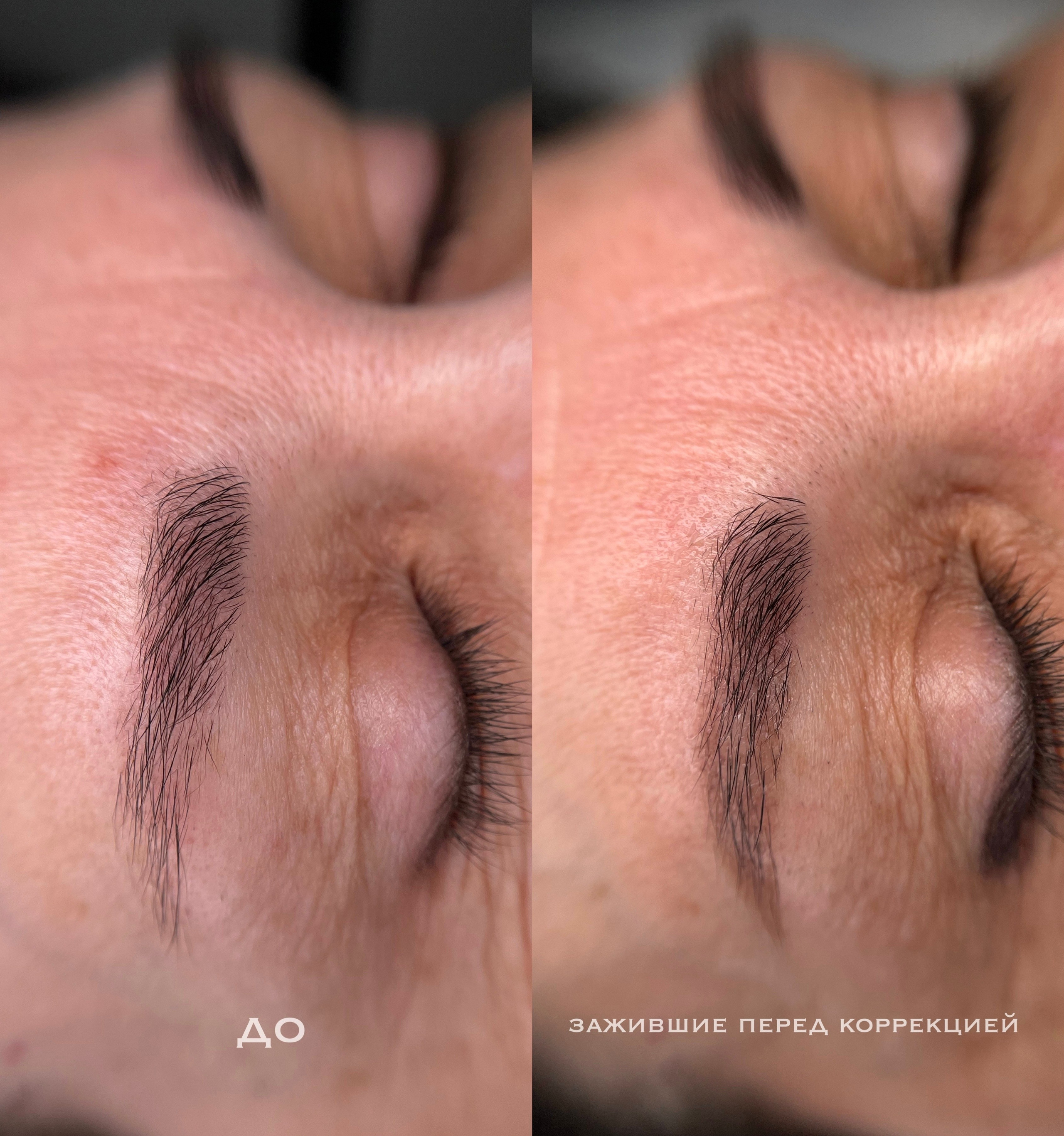 БРОВИ зажившие. Перманентный макияж и удаление старого татуажа в Ростове-на-Дону Дарья Исакова