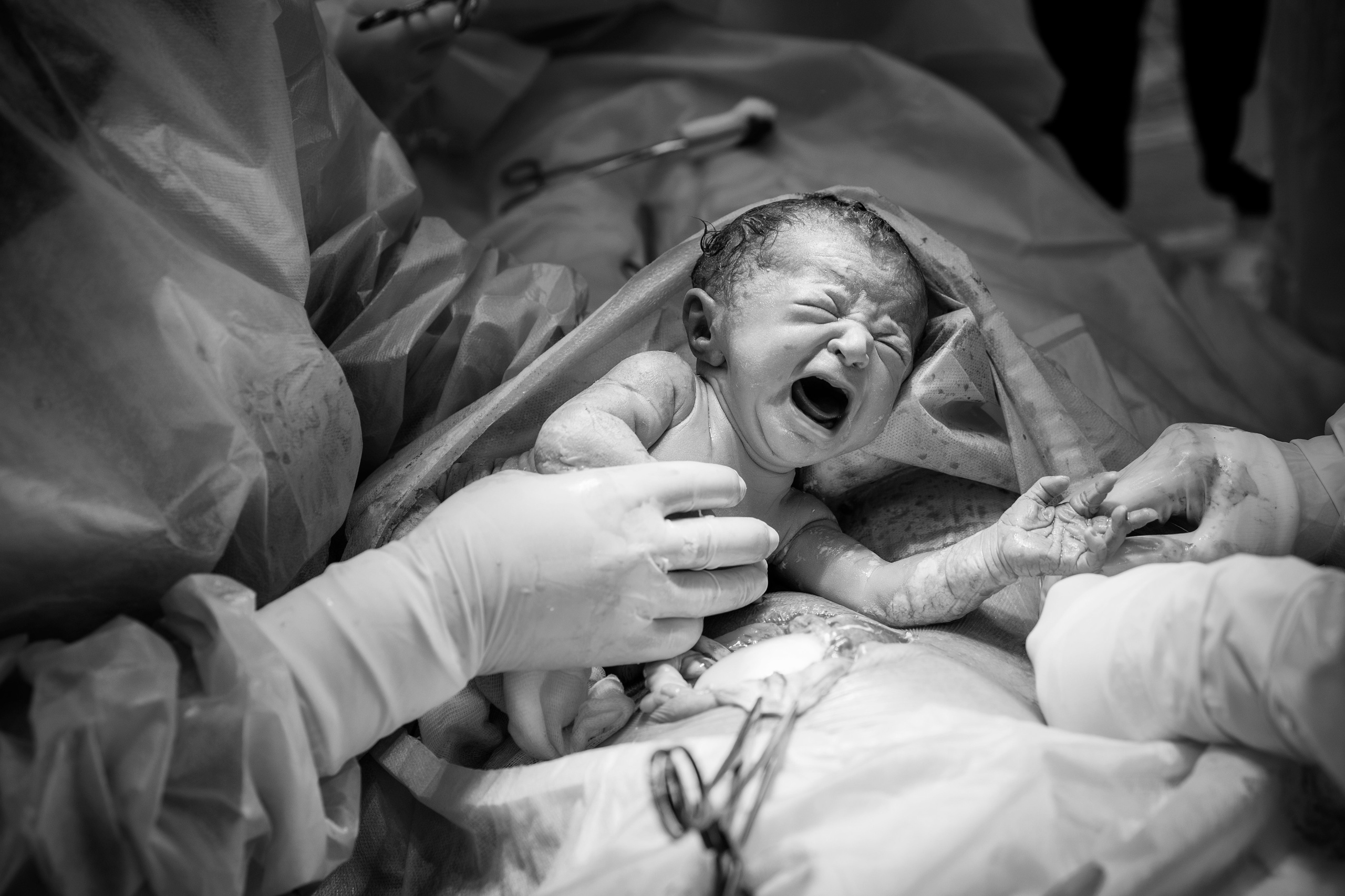 Фотография в родах