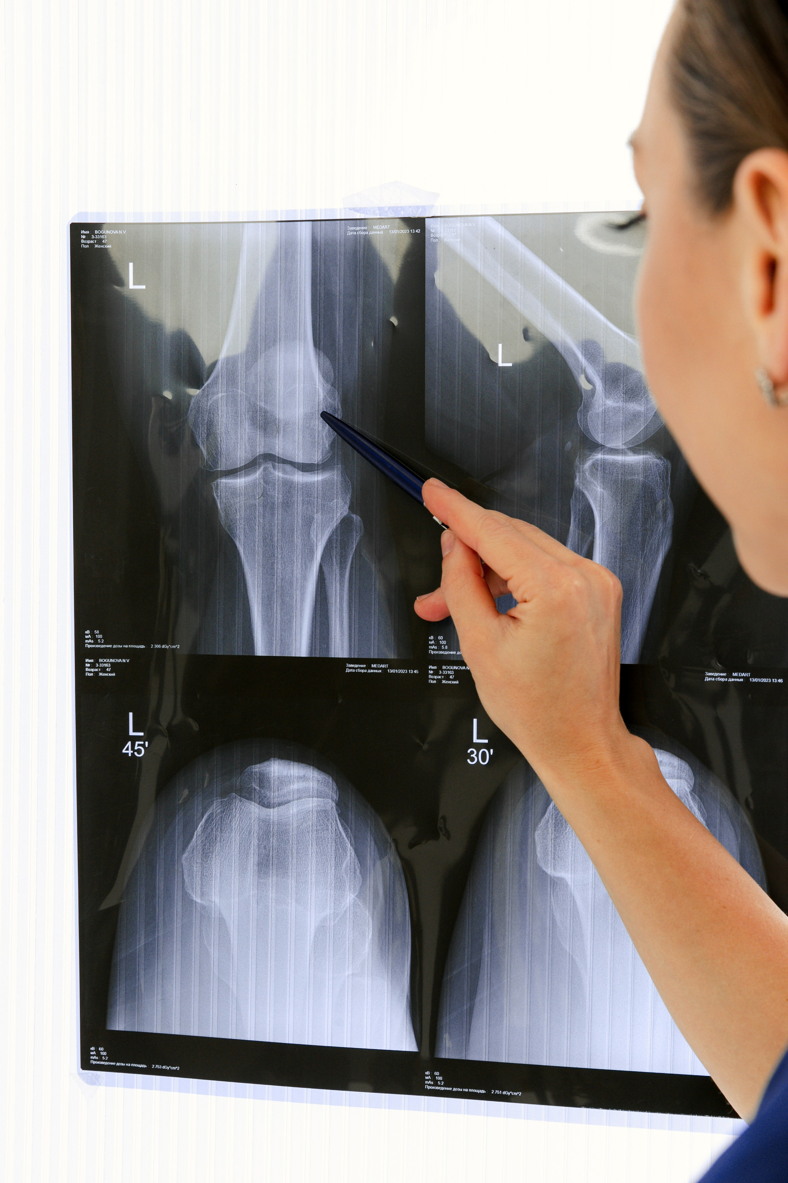 Контентная съемкка для врача-травматолога Таисии Аксеновой. Фотограф г. Москва и Ярославль