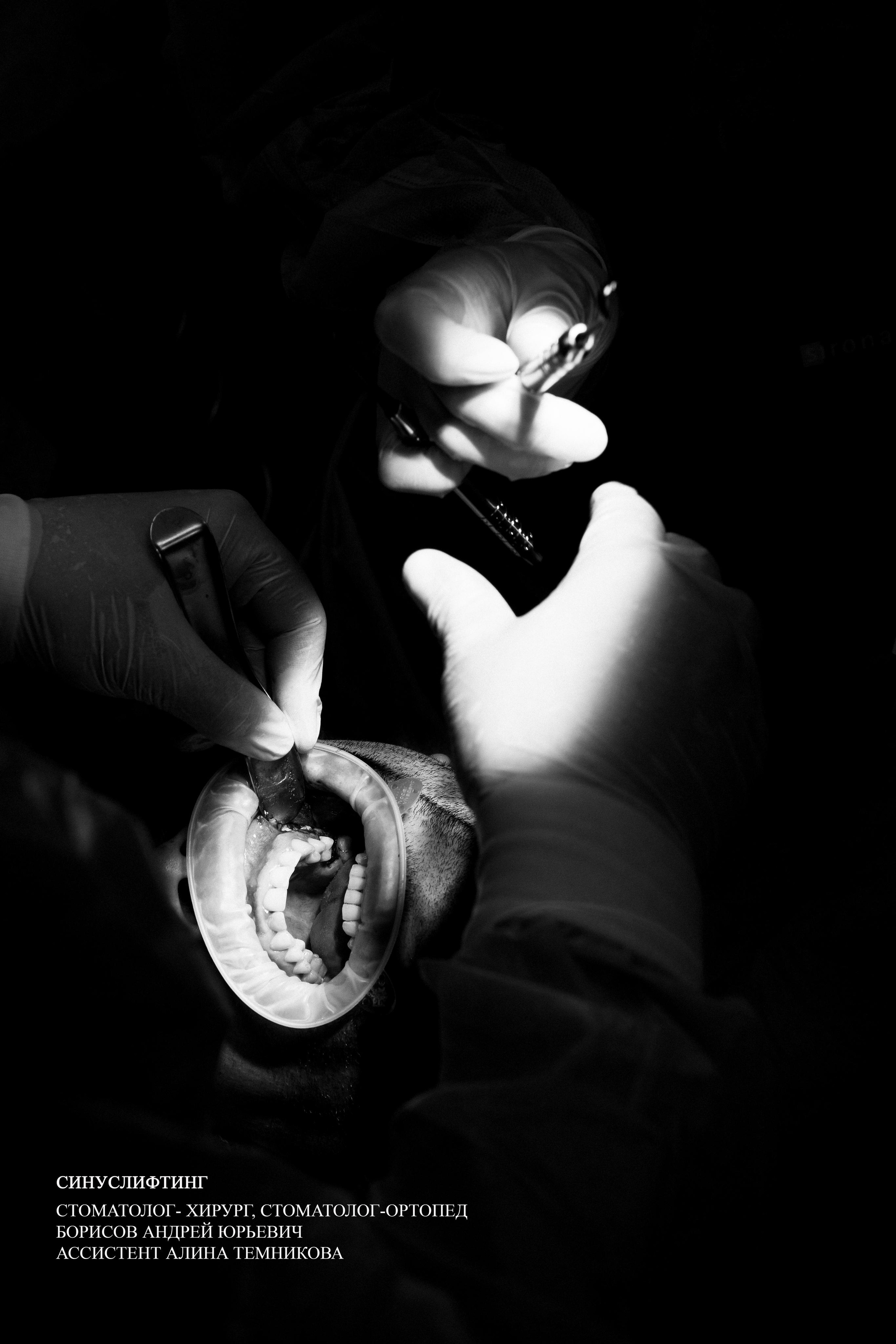 Фотовыставка. Светя другим, сгораю сам. Фотограф в жанре Ню. Татьяна Хасанович. Красноярск