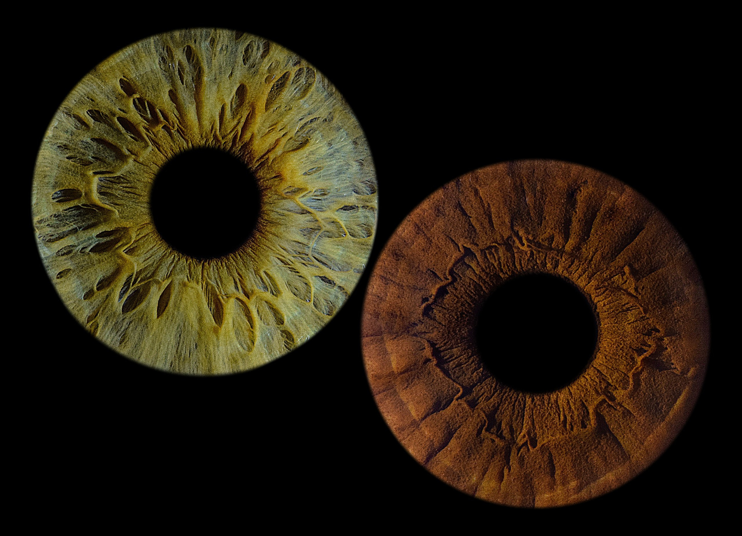 Портфолио. EYEtob | Фотография радужной оболочки | Тобольск