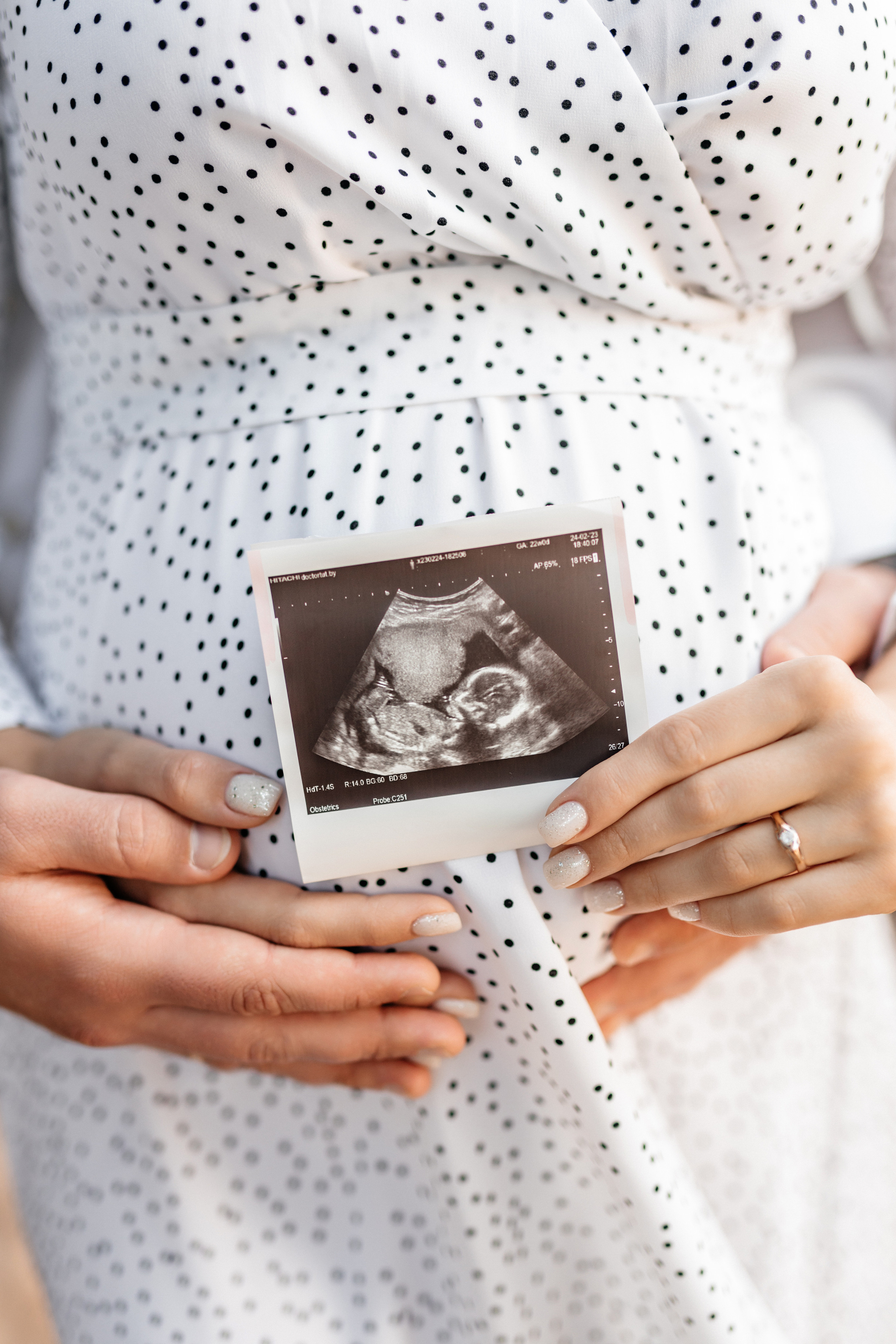Беременность. Свадебный фотограф в Минске Наталья Булатова