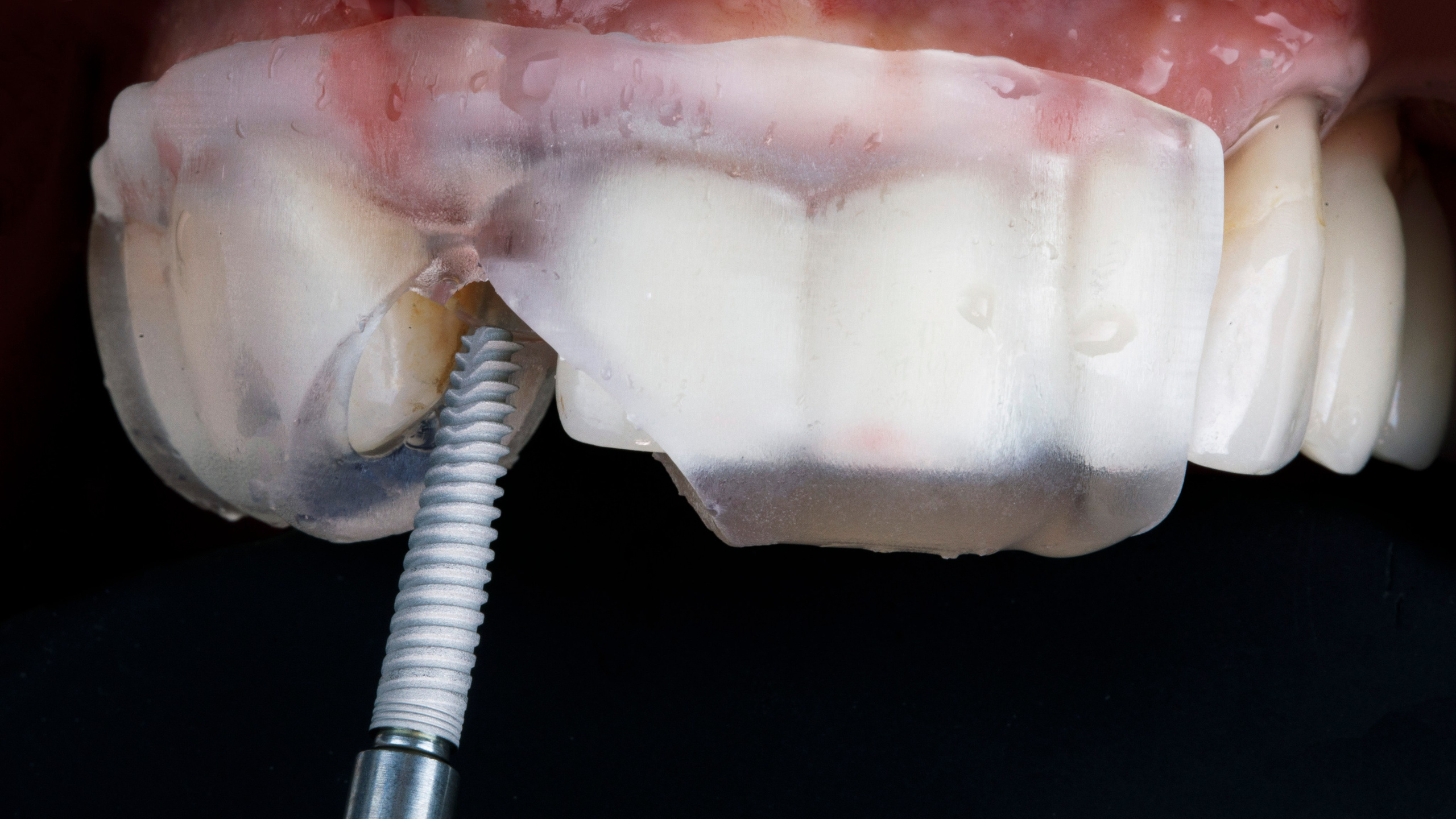 Хирургия. Дентал фотограф — видеограф Денис Дорошенко