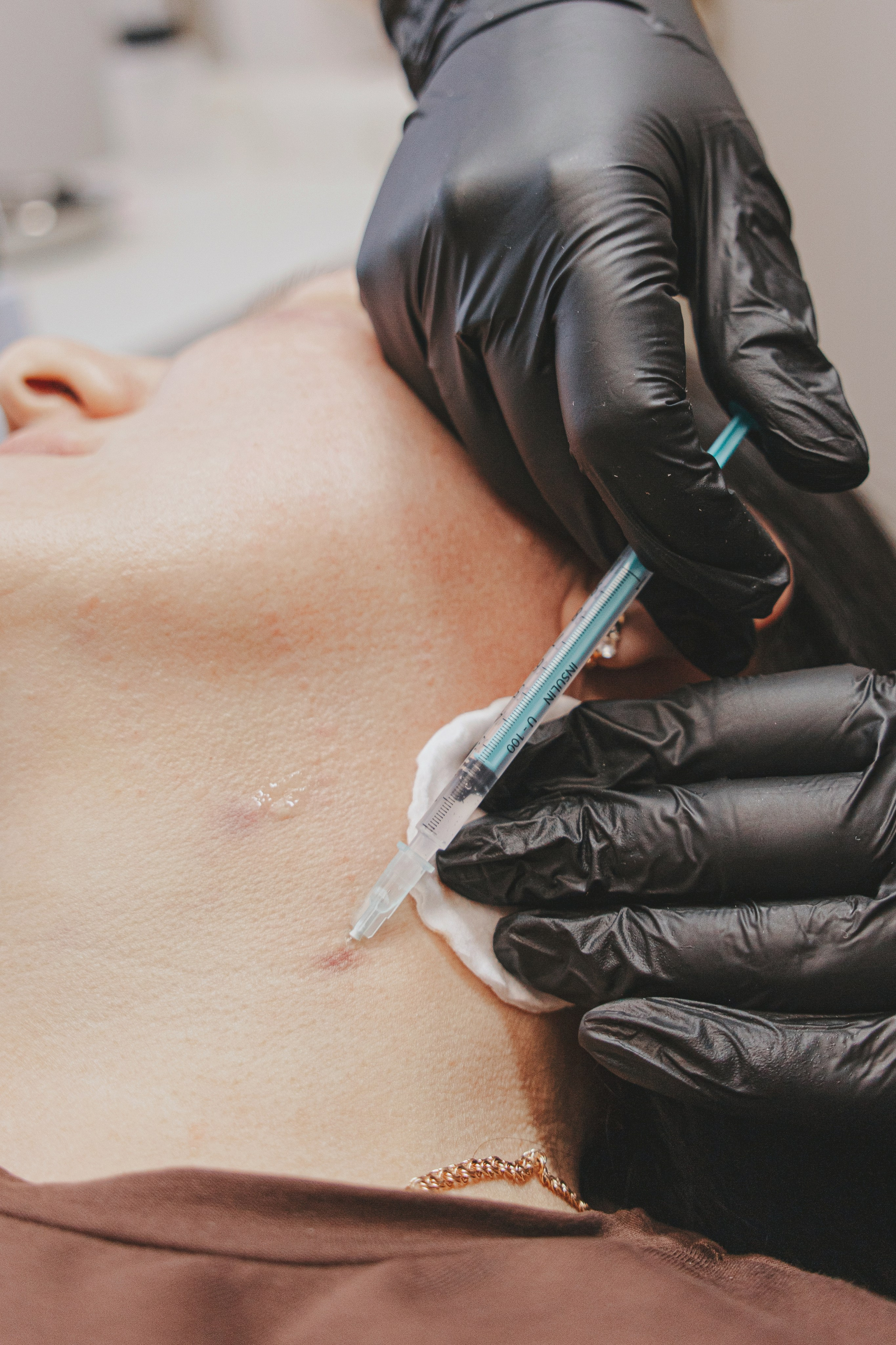 Косметолог проводит инъекции в лицо пациентке в современном светлом кабинете. Курск