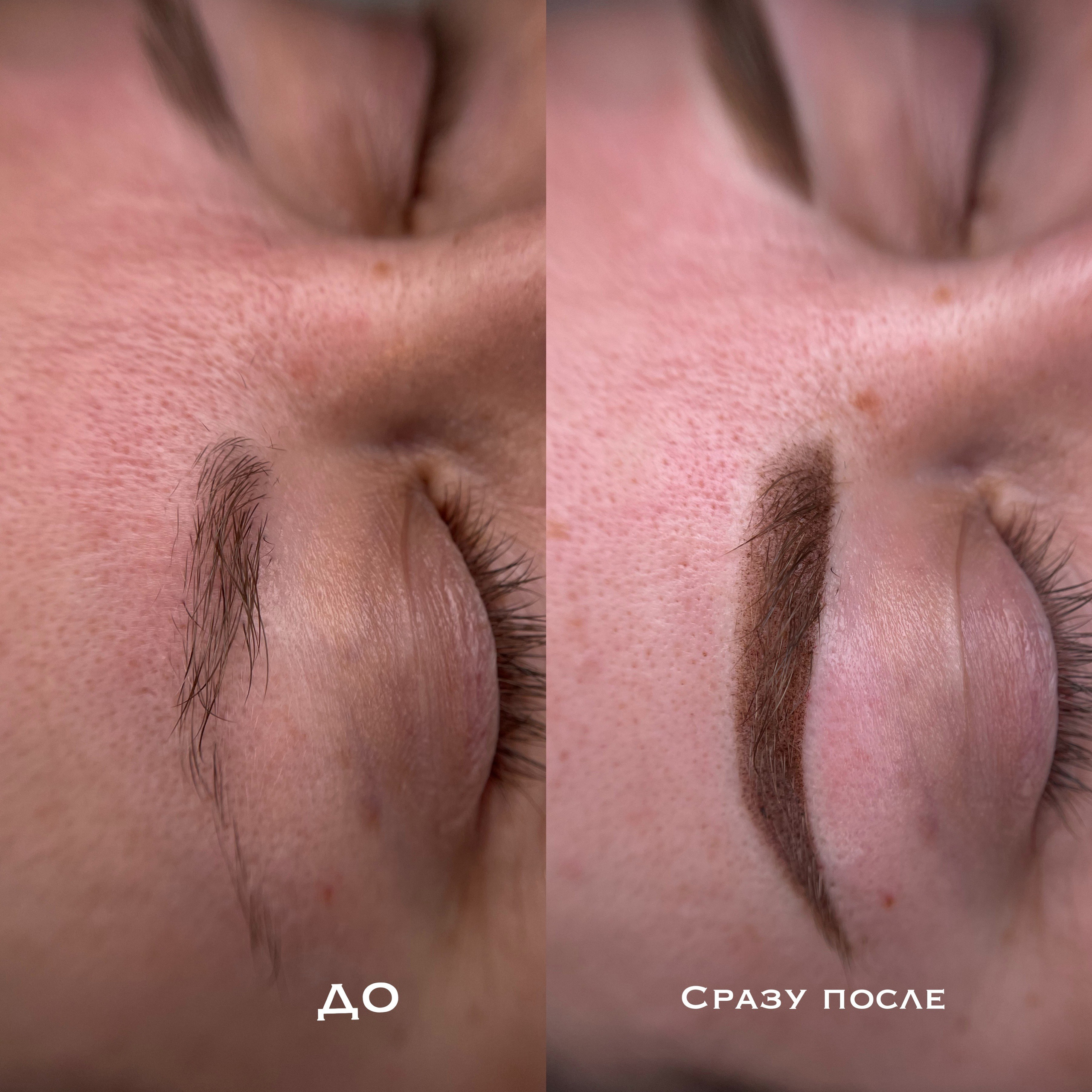 БРОВИ сразу после процедуры. Перманентный макияж и удаление старого татуажа в Ростове-на-Дону Дарья Исакова