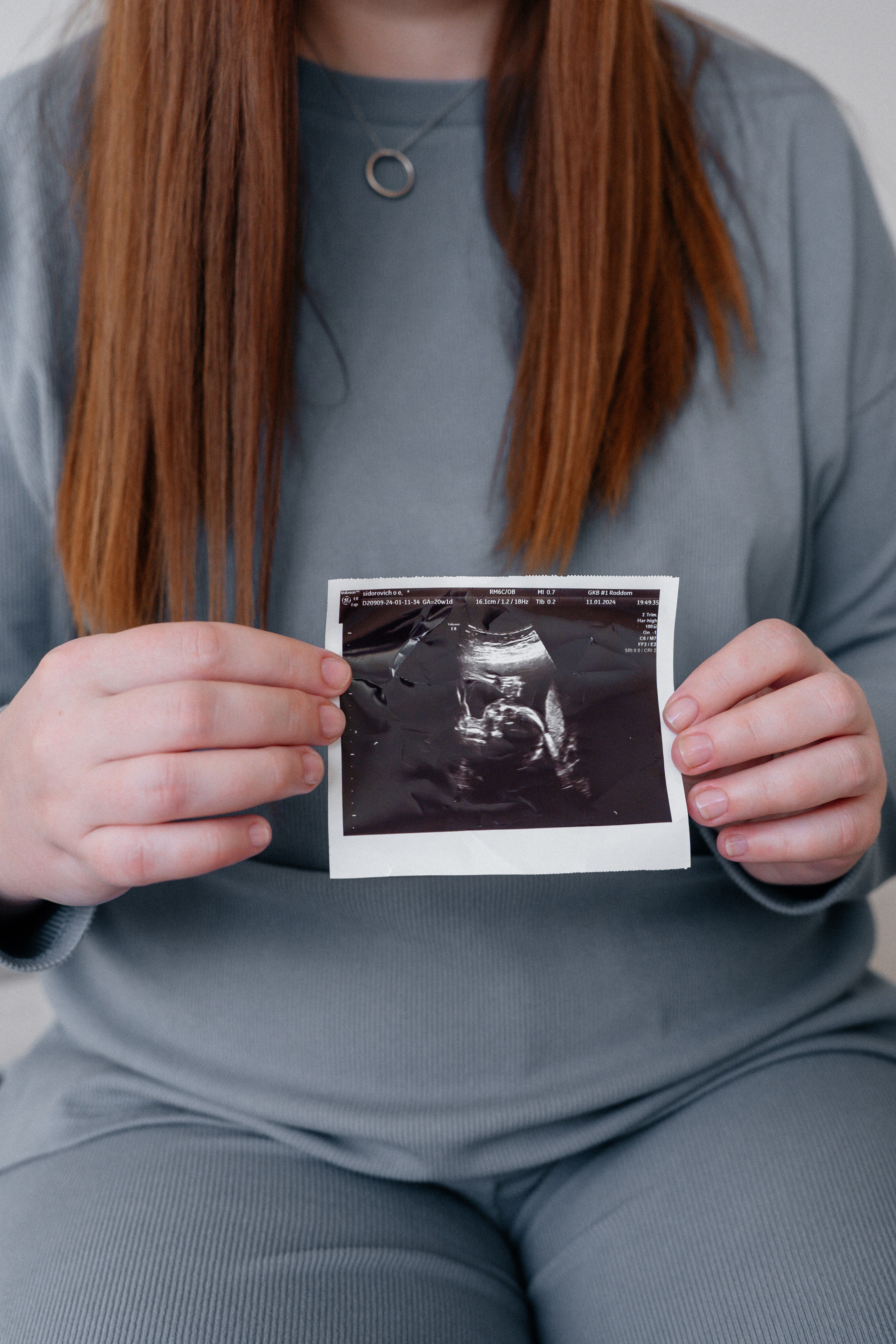 Нежность ожидания: фотосессия беременной девушки. Ваш семейный фотограф в Минске — Вика Трегубова