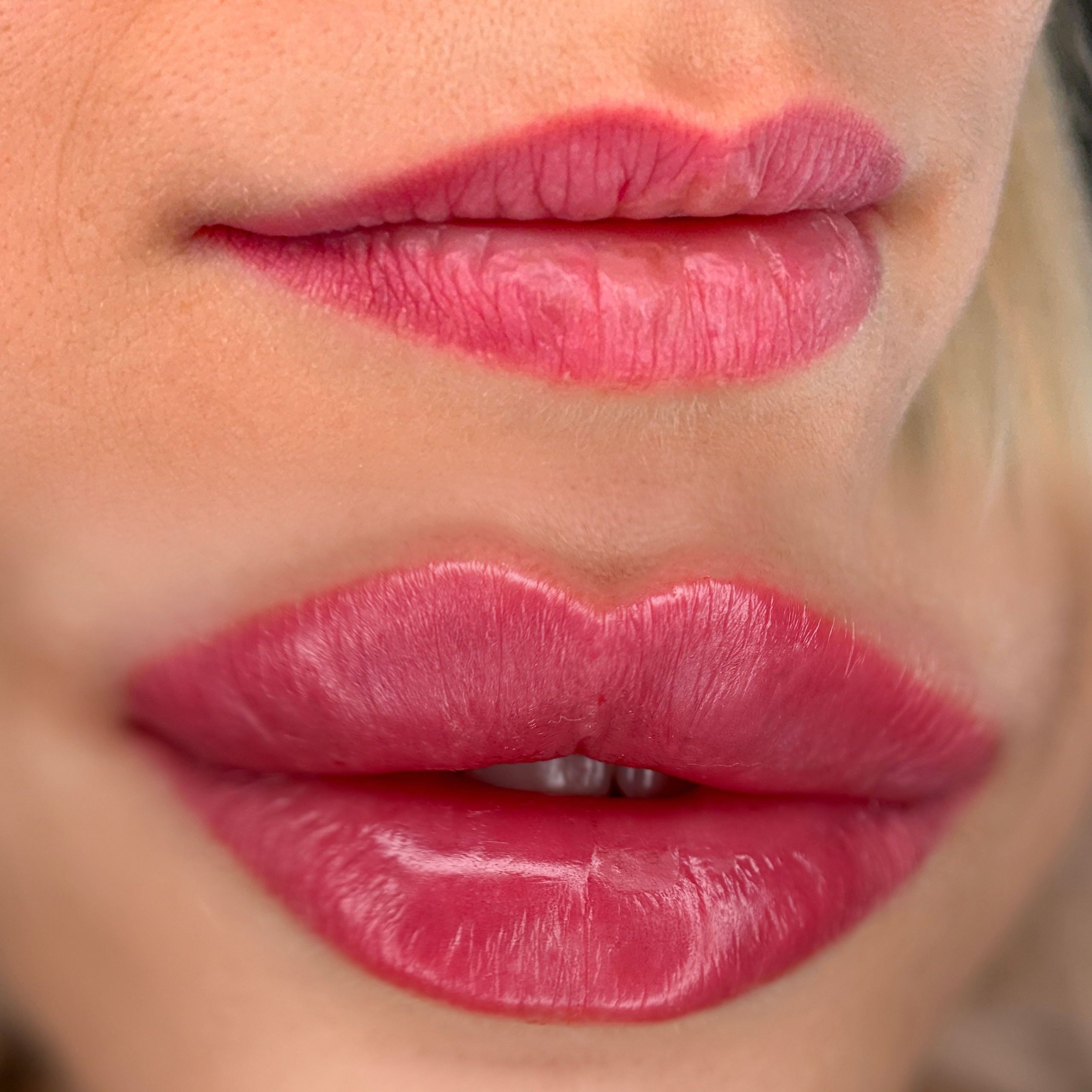 Инъекционная косметология. Студия перманентного макияжа, косметологии и массажа SYMMETRY в Москве, м. Киевская