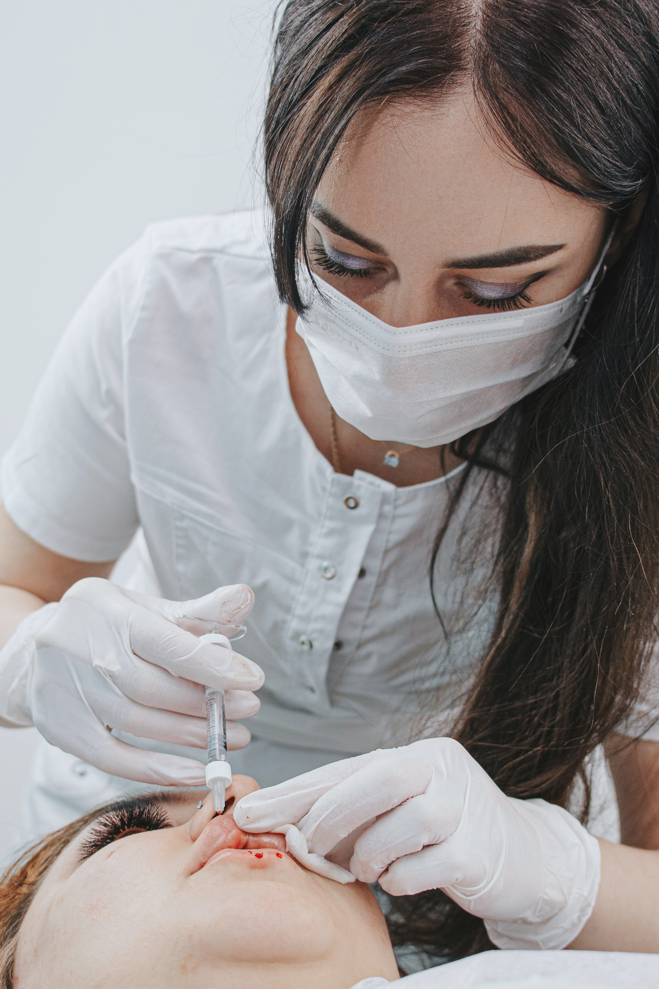 Крупный план рук косметолога в перчатках, шприц с филлером и губы пациента