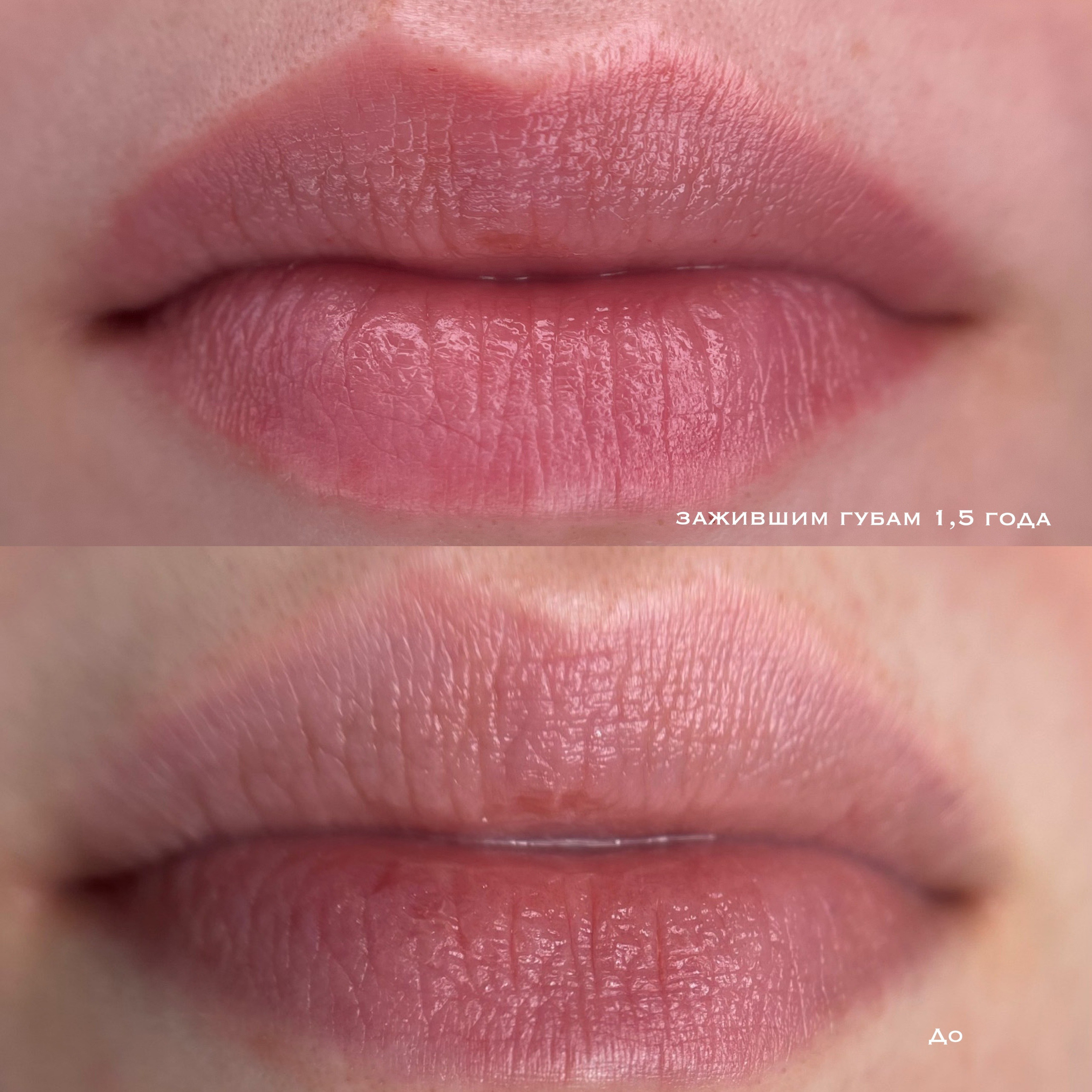 ГУБЫ зажившие. Перманентный макияж и удаление старого татуажа в Ростове-на-Дону Дарья Исакова