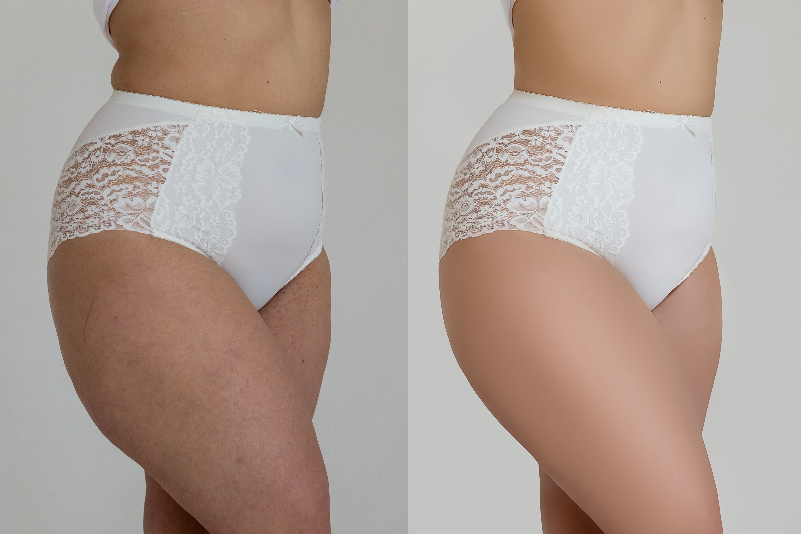 Деликатная обработка портретов для рекламы нижнего белья | Студия SVITHART