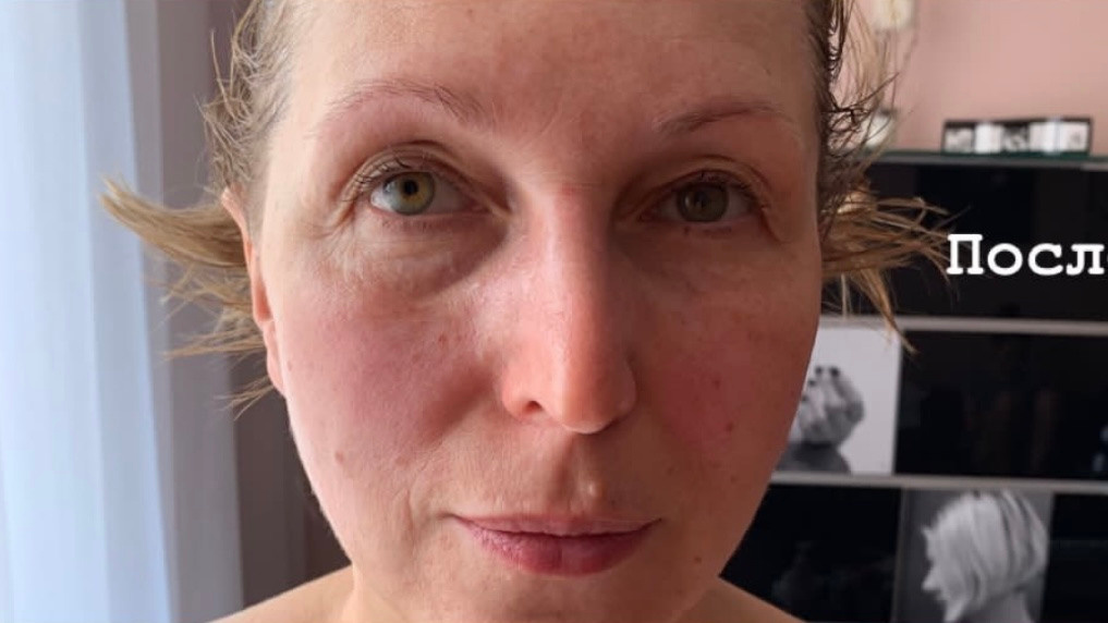 Отзывы. Массажист СПБ/МСК Facesaver