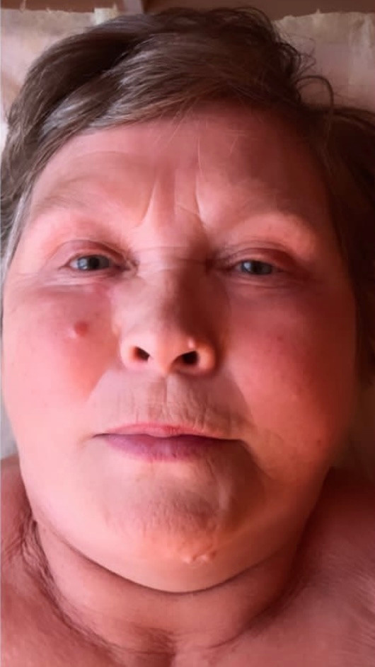 Отзывы. Массажист СПБ/МСК Facesaver