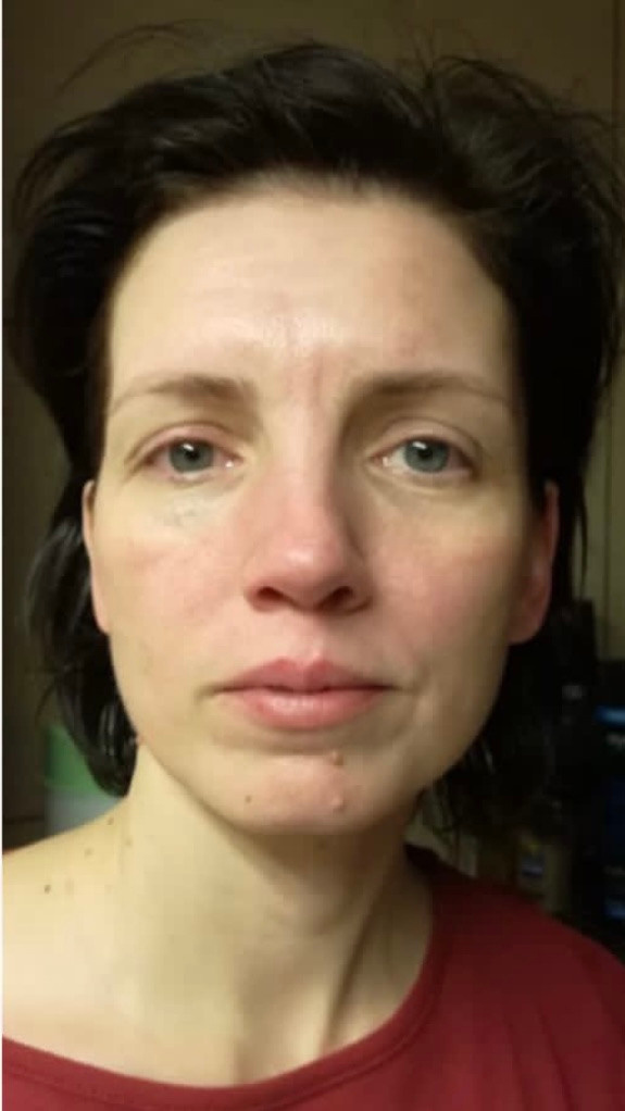 Отзывы. Массажист СПБ/МСК Facesaver