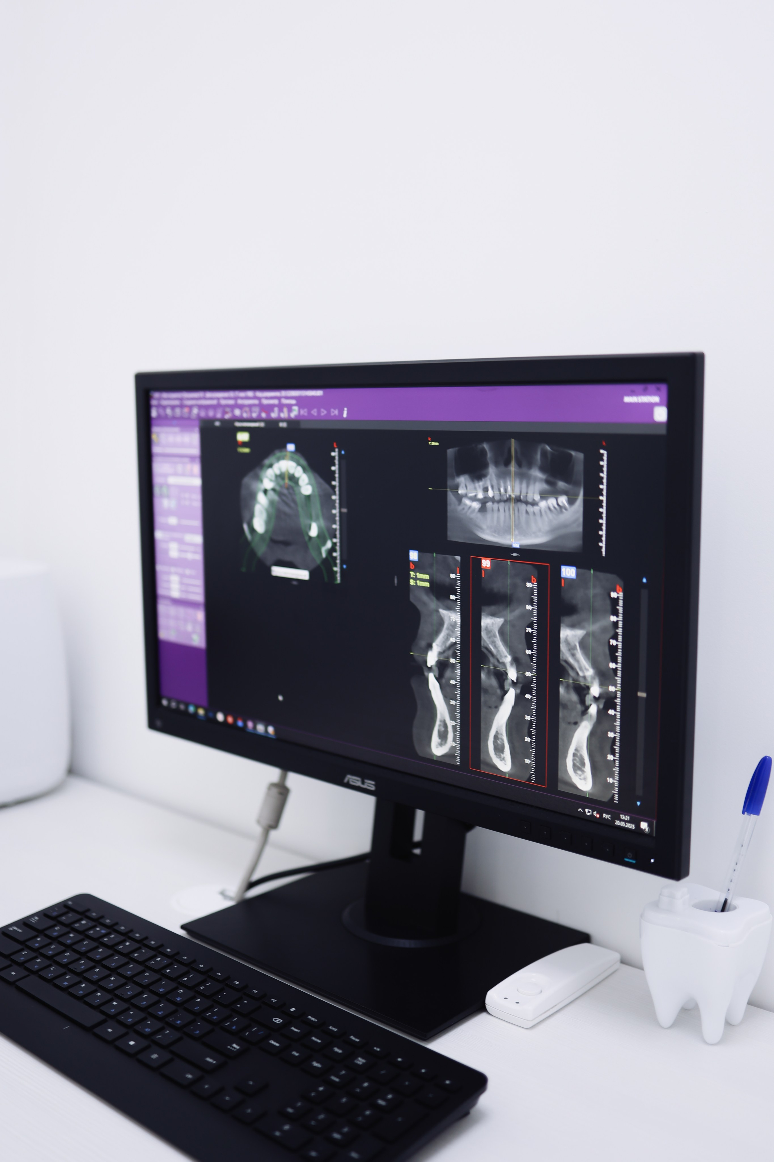 Стоматология. Withlovent | Фотограф в Севастополе