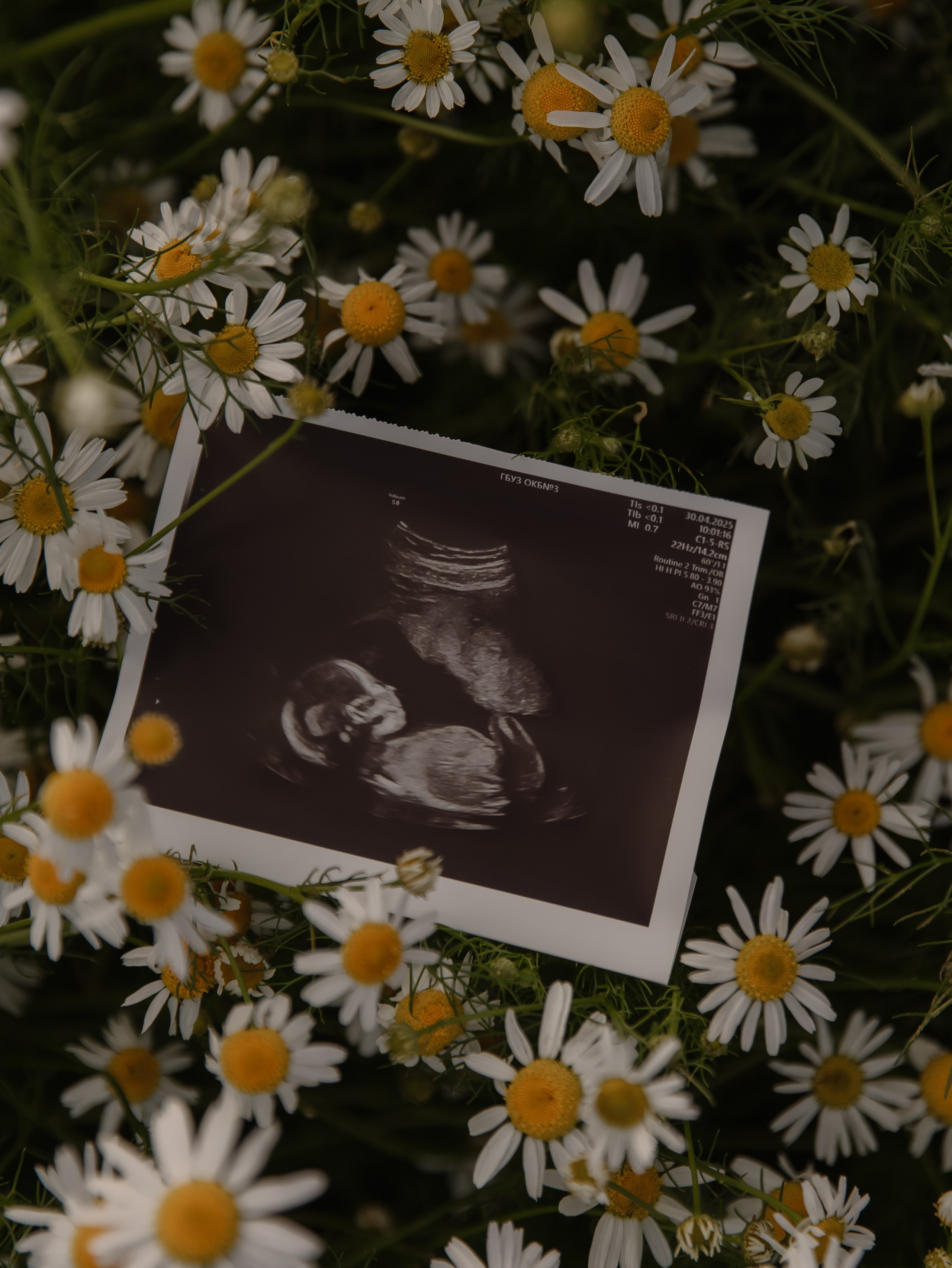 Фотосессия в ромашках Челябинск. СВАДЕБНЫЙ ФОТОГРАФ ЧЕЛЯБИНСК