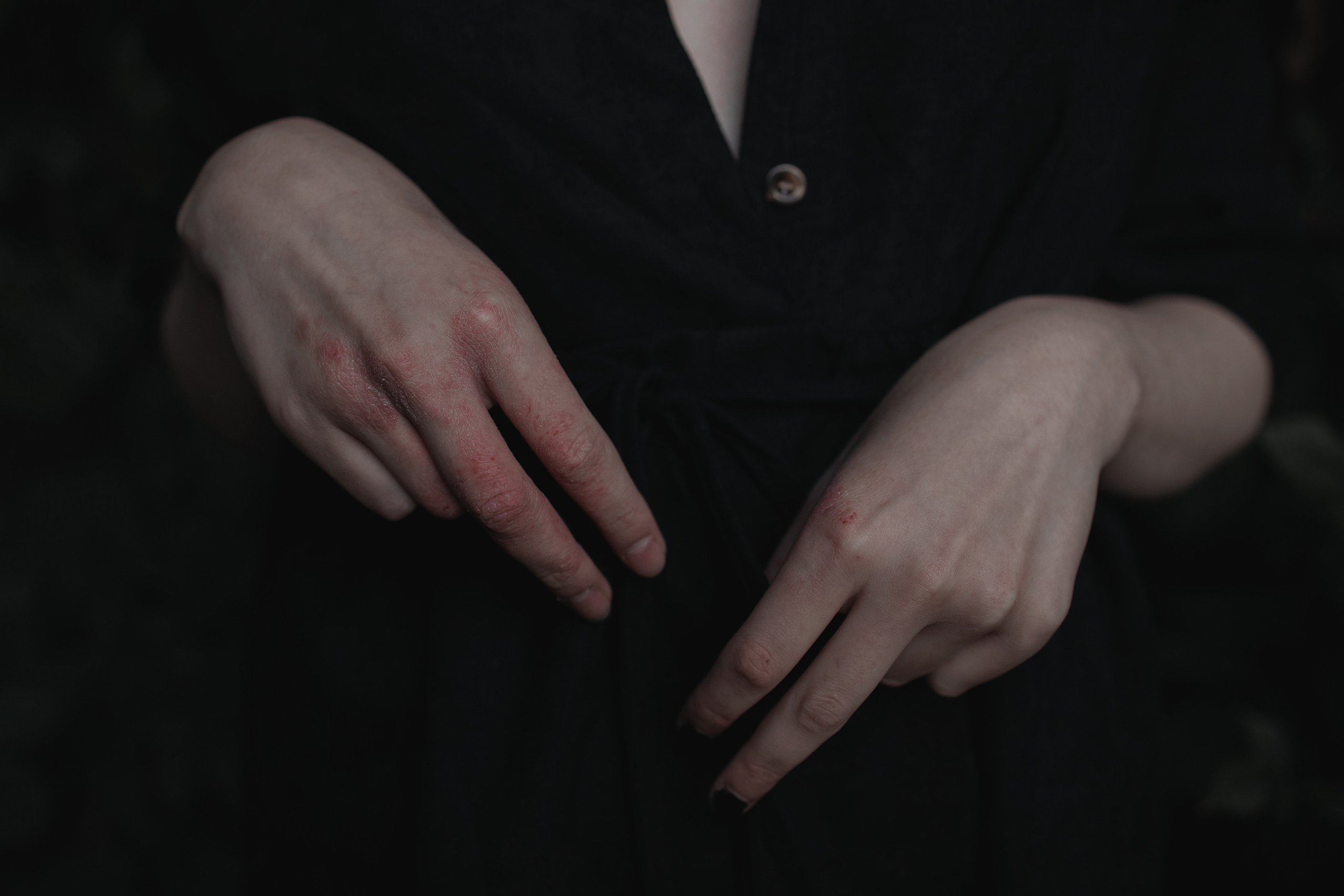 Mental disorder. Арт-фотограф. Coffelisk