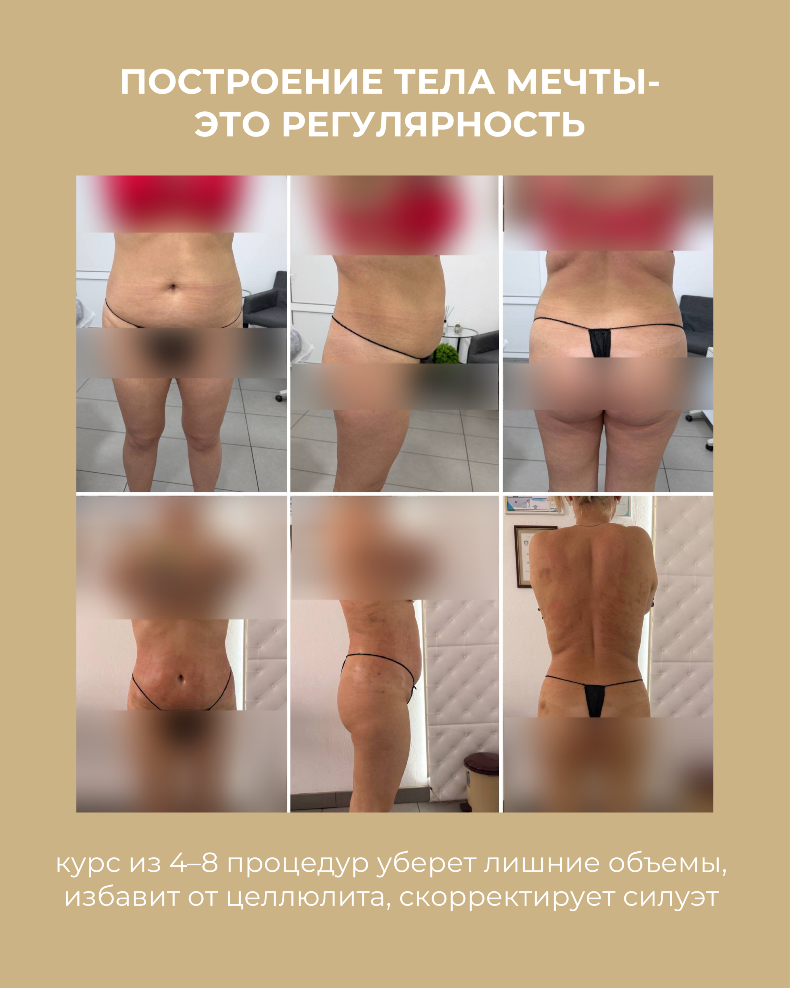 РЕЗУЛЬТАТЫ КЛИЕНТОВ ДО/ПОСЛЕ. Центр аппаратной косметологии IVI