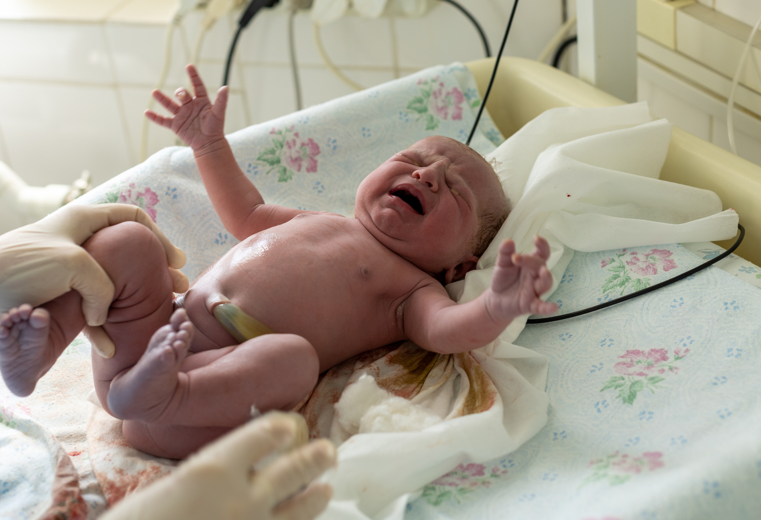 Фотографии Операция Кесарево сечения. Фотограф новорожденных в Нижнем Новгороде Надежда Кадылкина