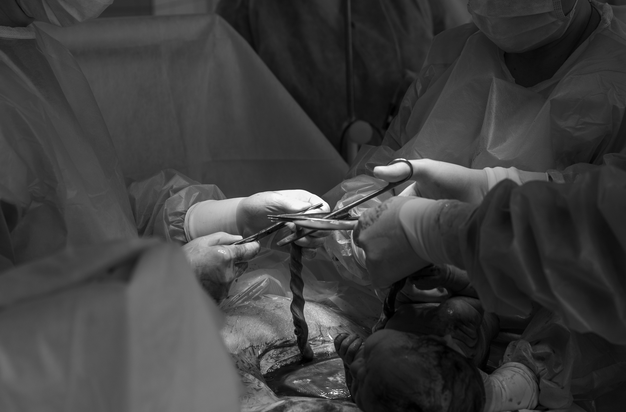 Фотографии Операция Кесарево сечения. Фотограф новорожденных в Нижнем Новгороде Надежда Кадылкина