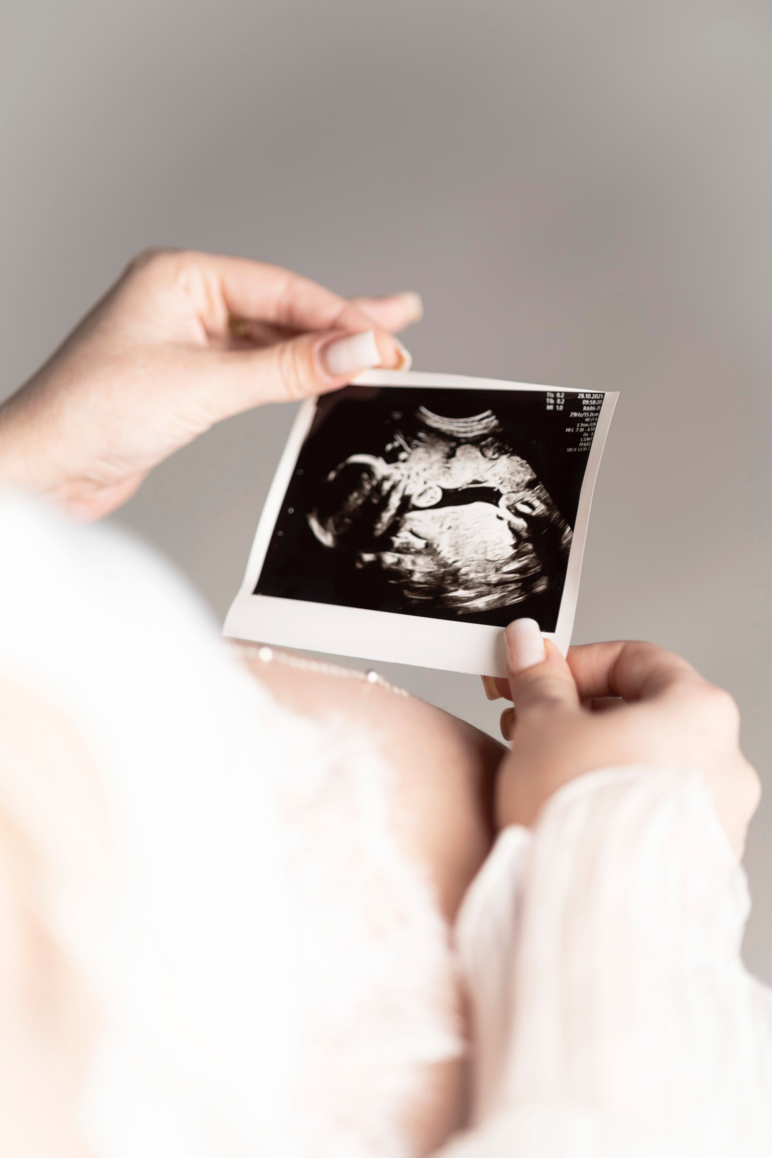 Алёна. YANA KIDVSKAT