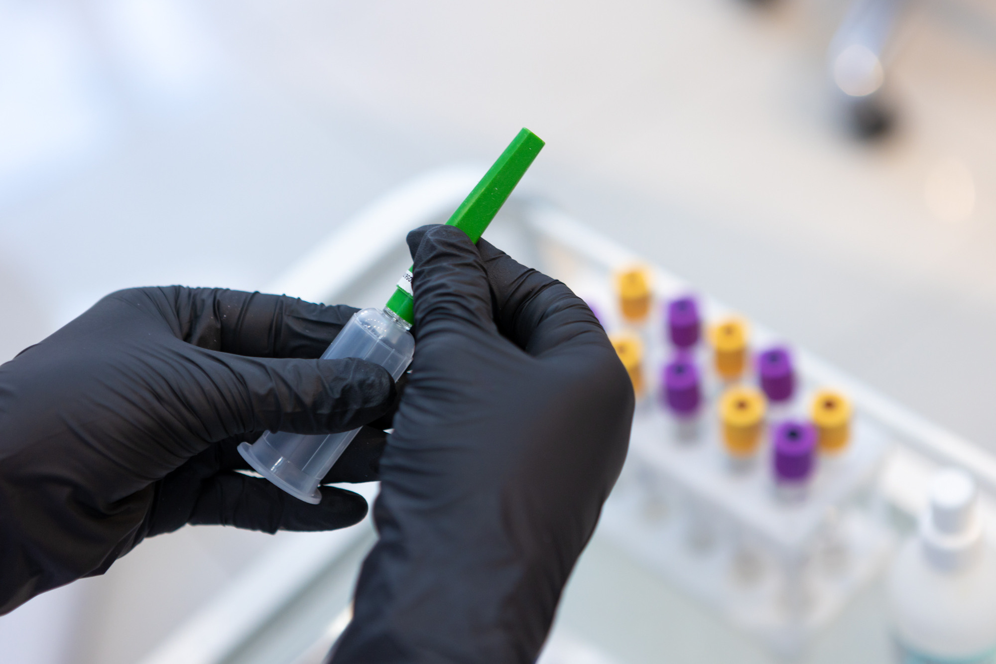 Кровь на анализы в оренбурге. Фотограф в Оренбурге. Профессиональный фотограф