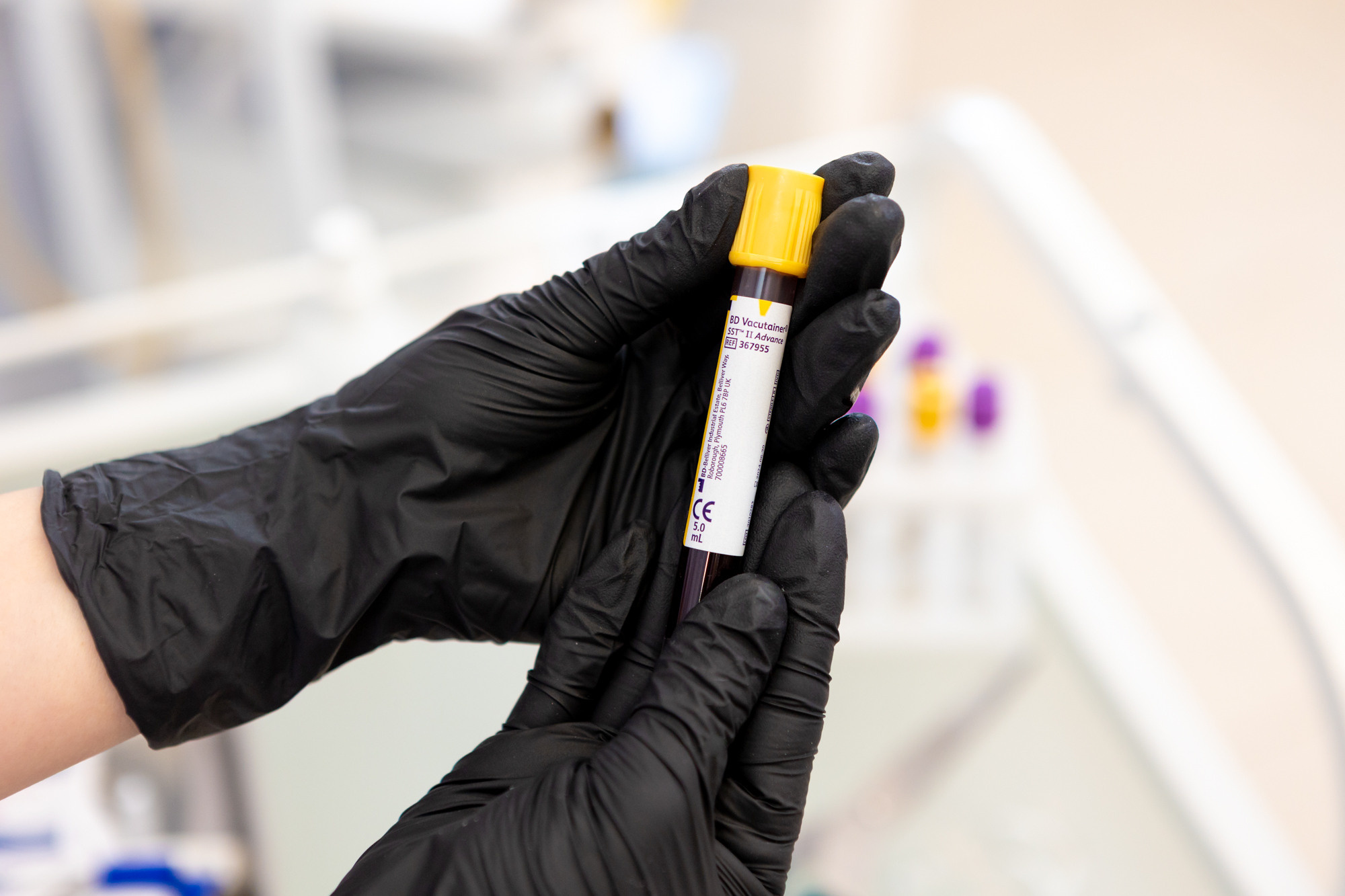 Кровь на анализы в оренбурге. Фотограф в Оренбурге. Профессиональный фотограф