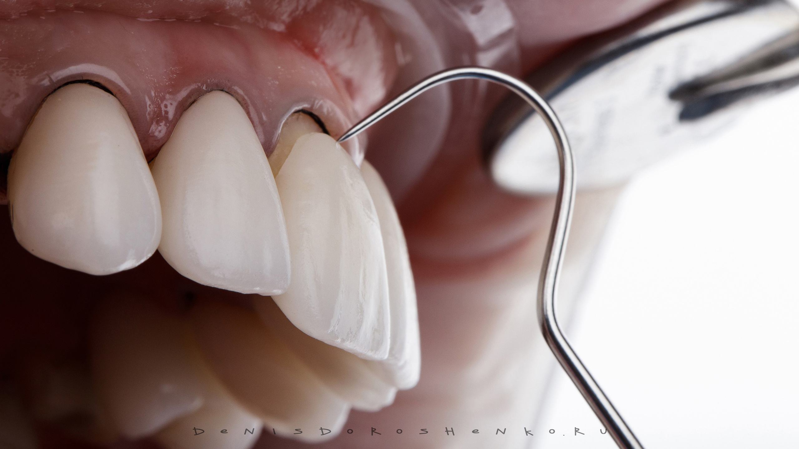 Ортопедия. Дентал фотограф — видеограф Денис Дорошенко