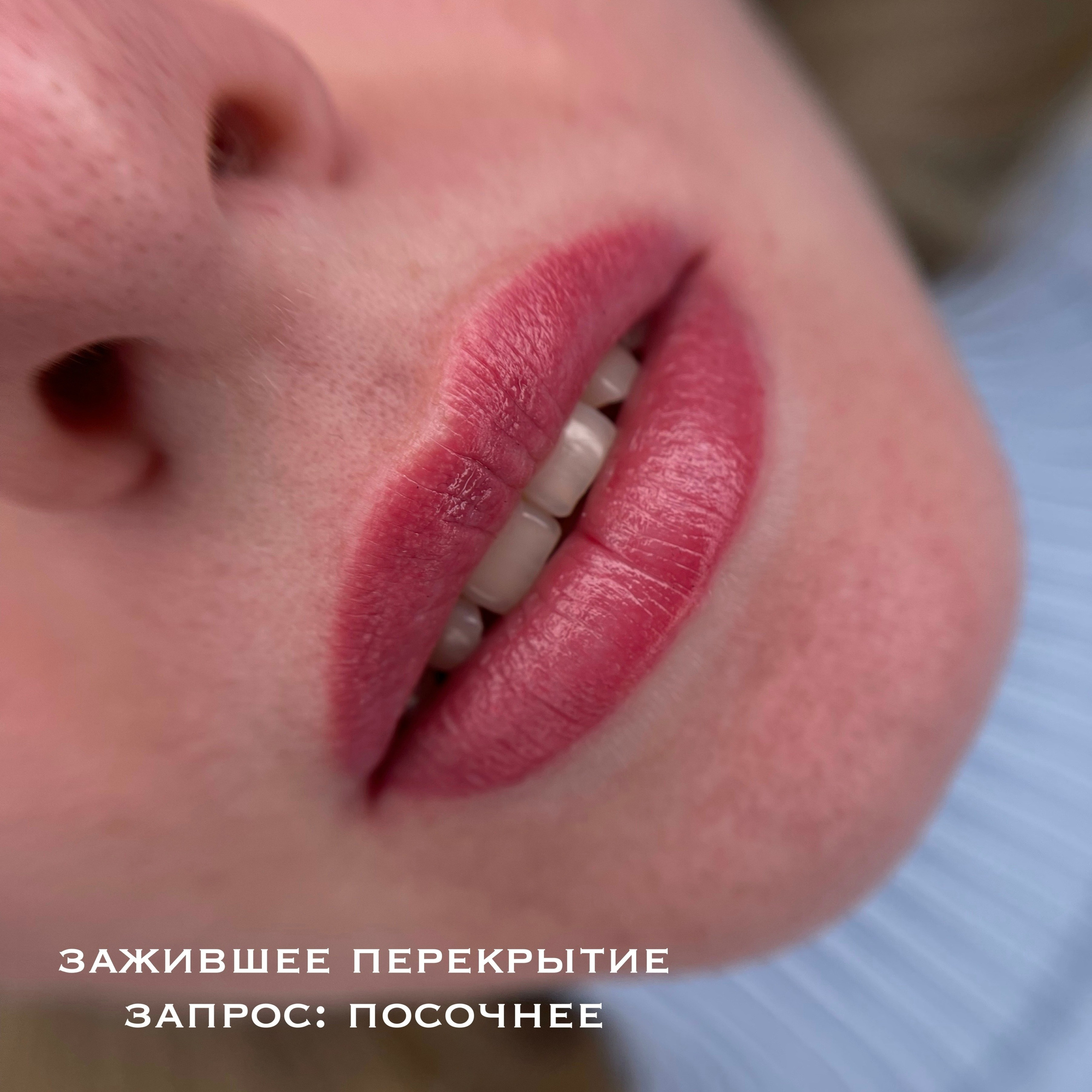 ГУБЫ зажившие. Перманентный макияж и удаление старого татуажа в Ростове-на-Дону Дарья Исакова