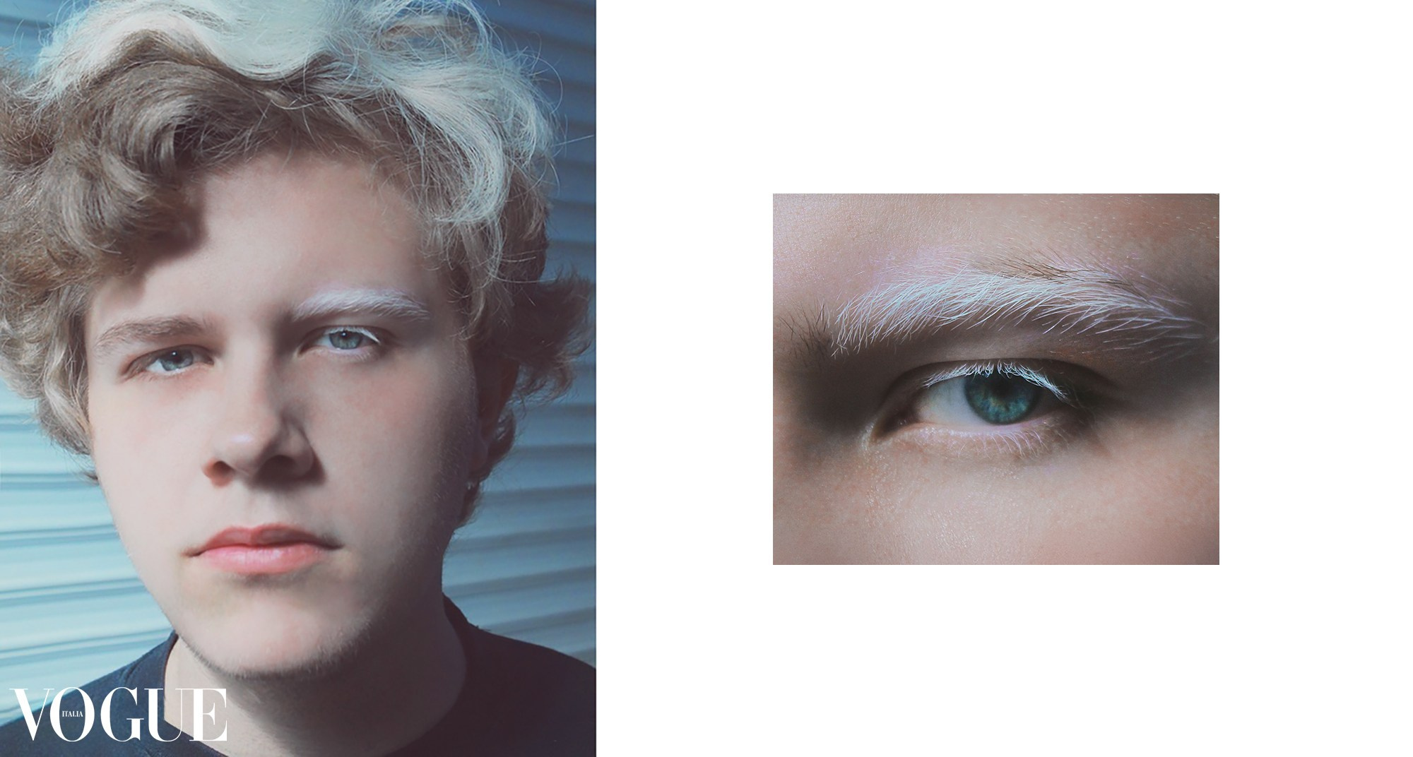 Витилиго. Фотограф из Москвы — DASHA NOVA | Авторская фотография в разных жанрах