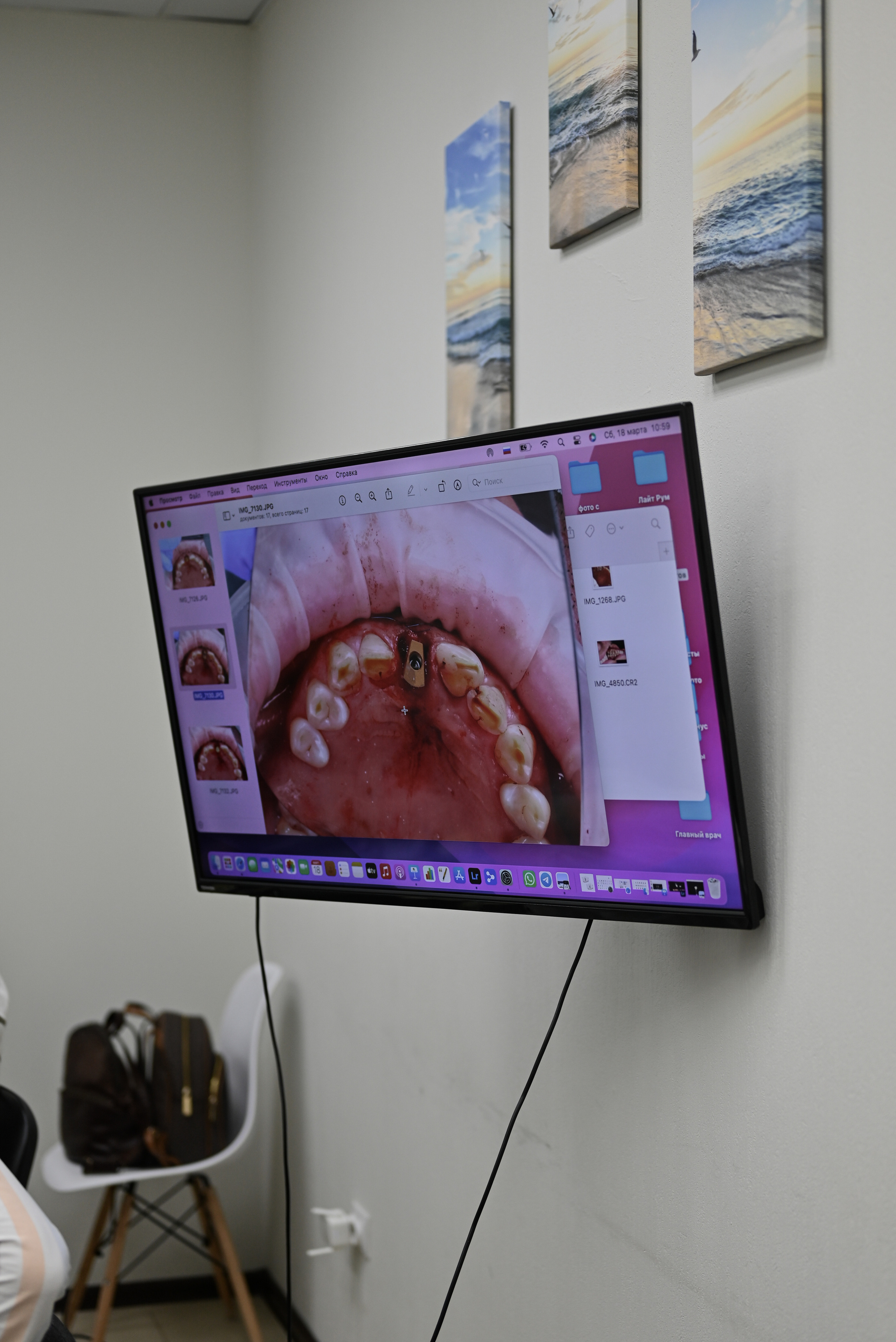 Стоматология доктора Томилиной (мастер класс). Свадебный и семейный фотограф в Уфе Александров Максим