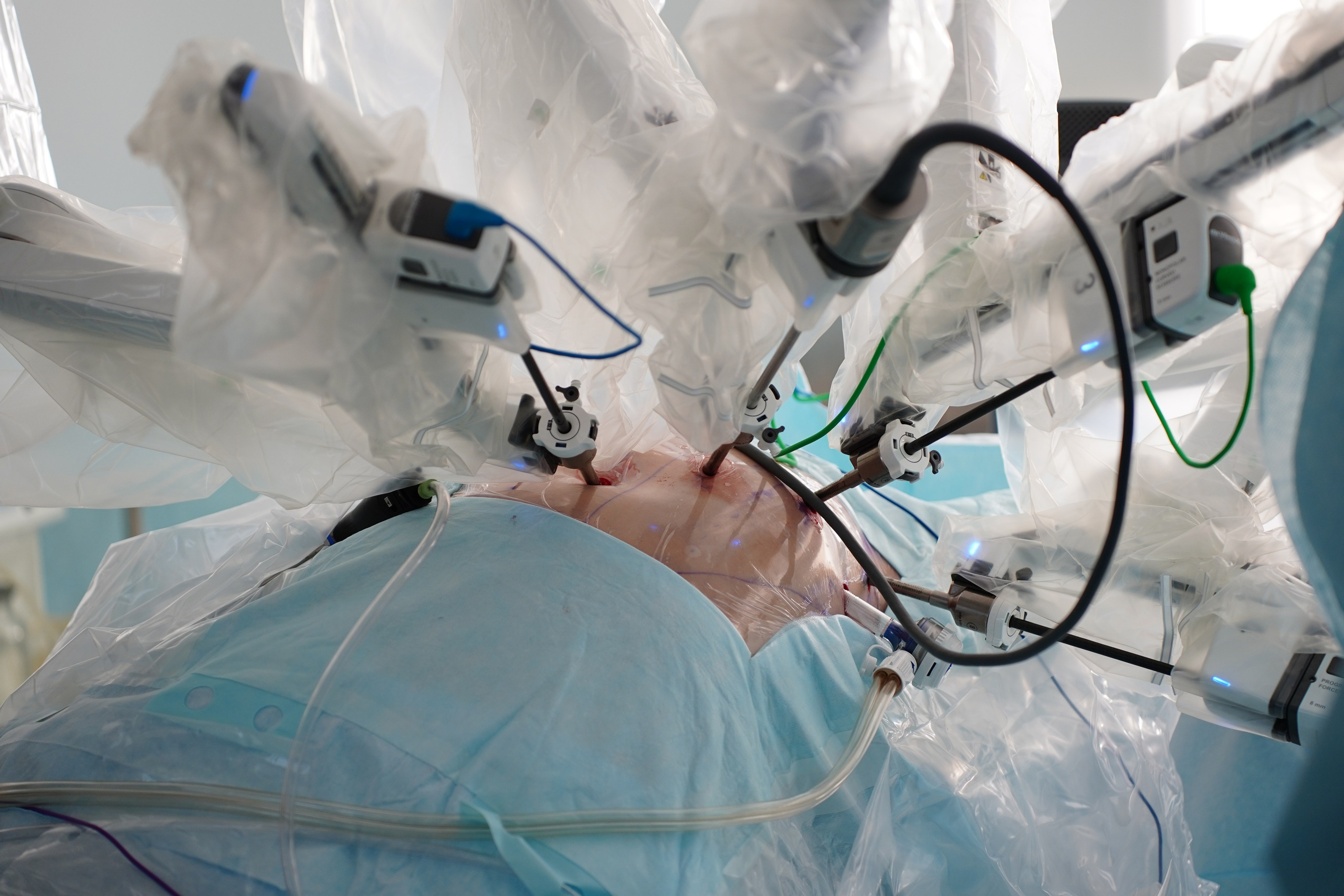 II Евразийский форум Колоректальной Хирурги EFCS. Pupov.png