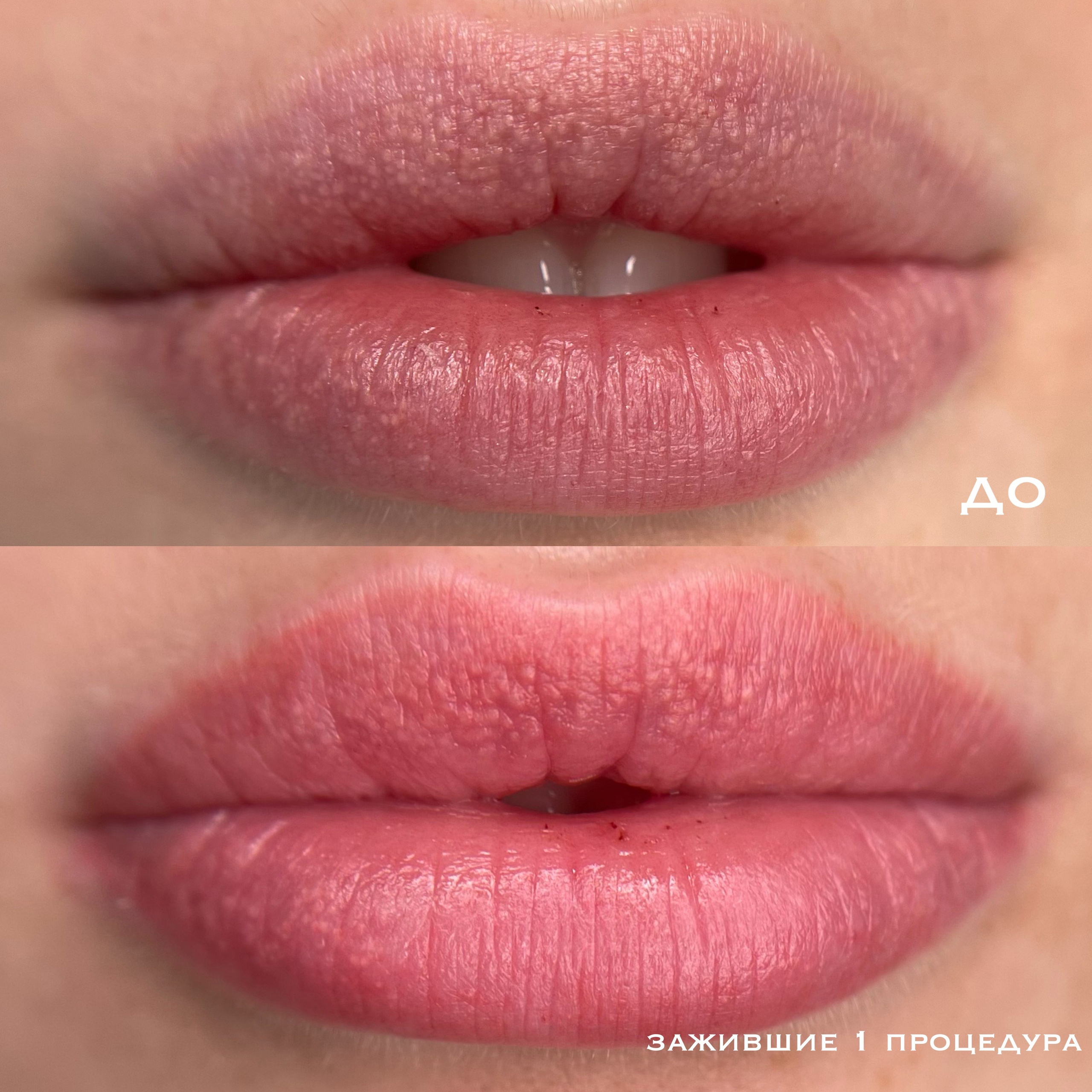 ГУБЫ зажившие. Перманентный макияж и удаление старого татуажа в Ростове-на-Дону Дарья Исакова