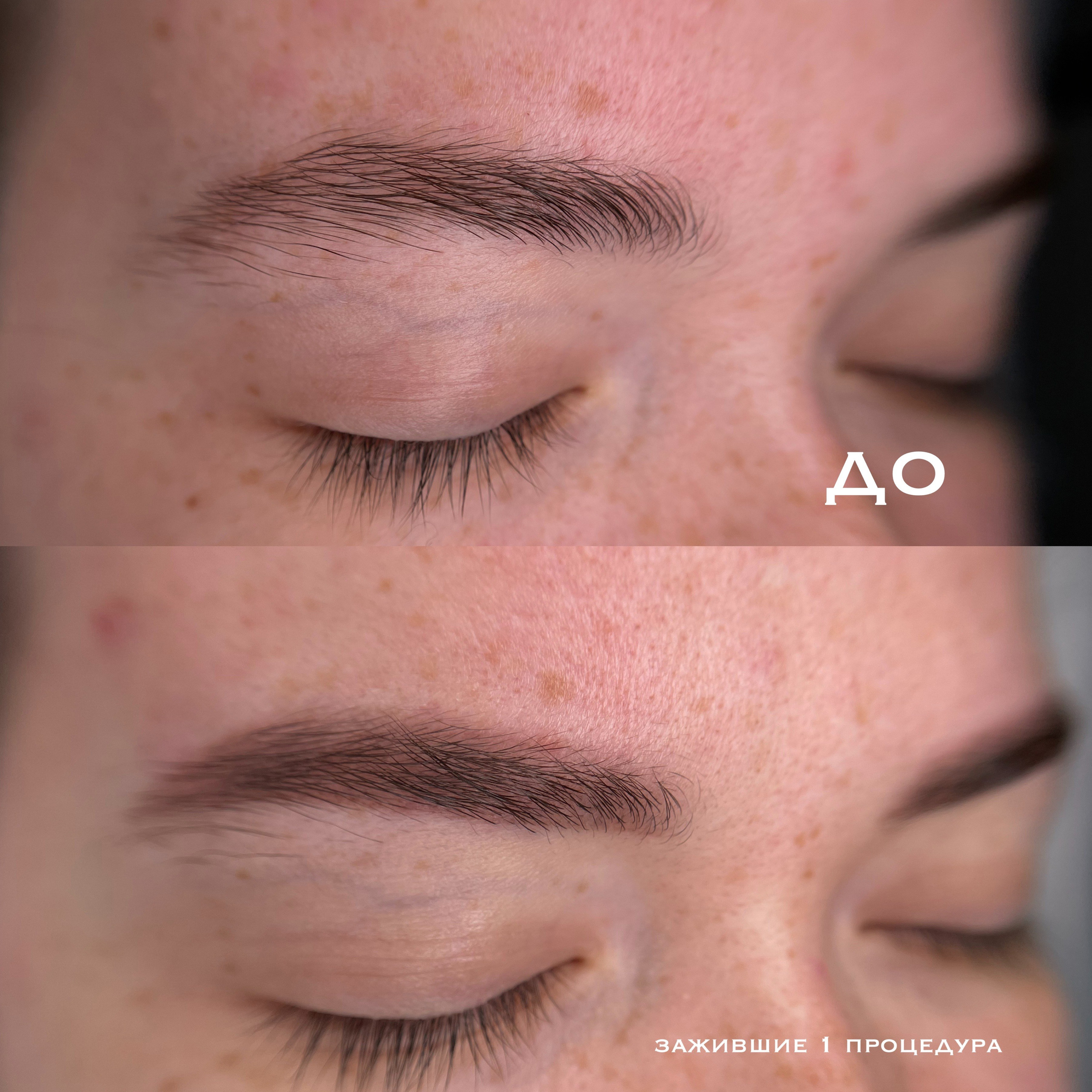 БРОВИ зажившие. Перманентный макияж и удаление старого татуажа в Ростове-на-Дону Дарья Исакова