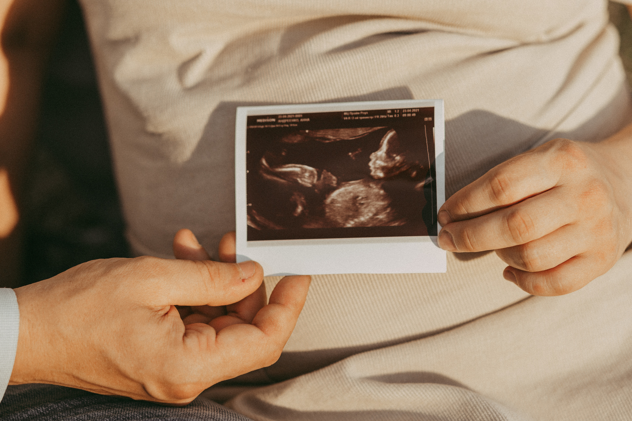 LOVE STORY 💞 БЕРЕМЕННОСТЬ. Семейный фотограф Ирис Сенченко