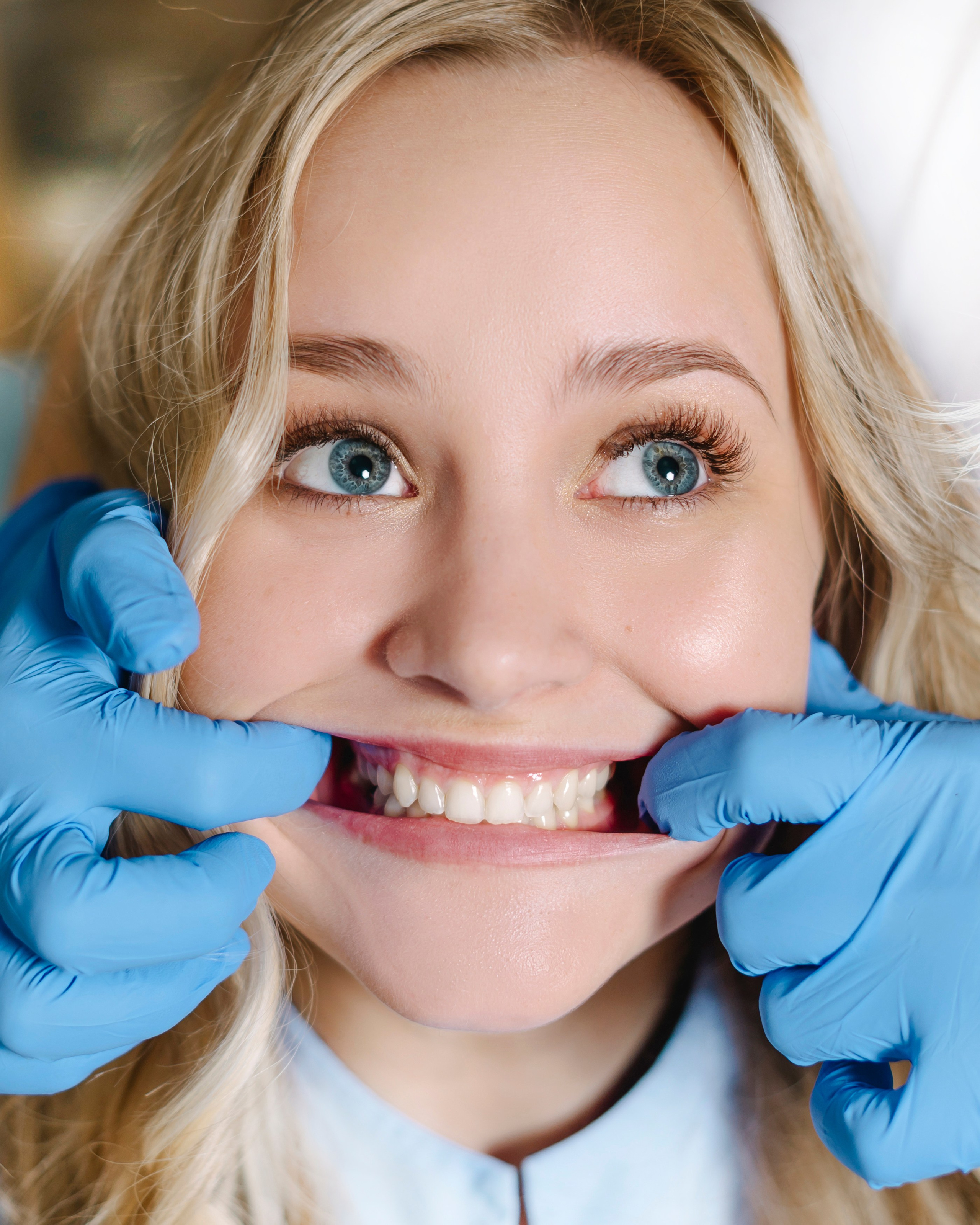 СТОМАТОЛОГИЯ. Шашкова Вероника / Свадебный и семейный фотограф Москва и Ярославль