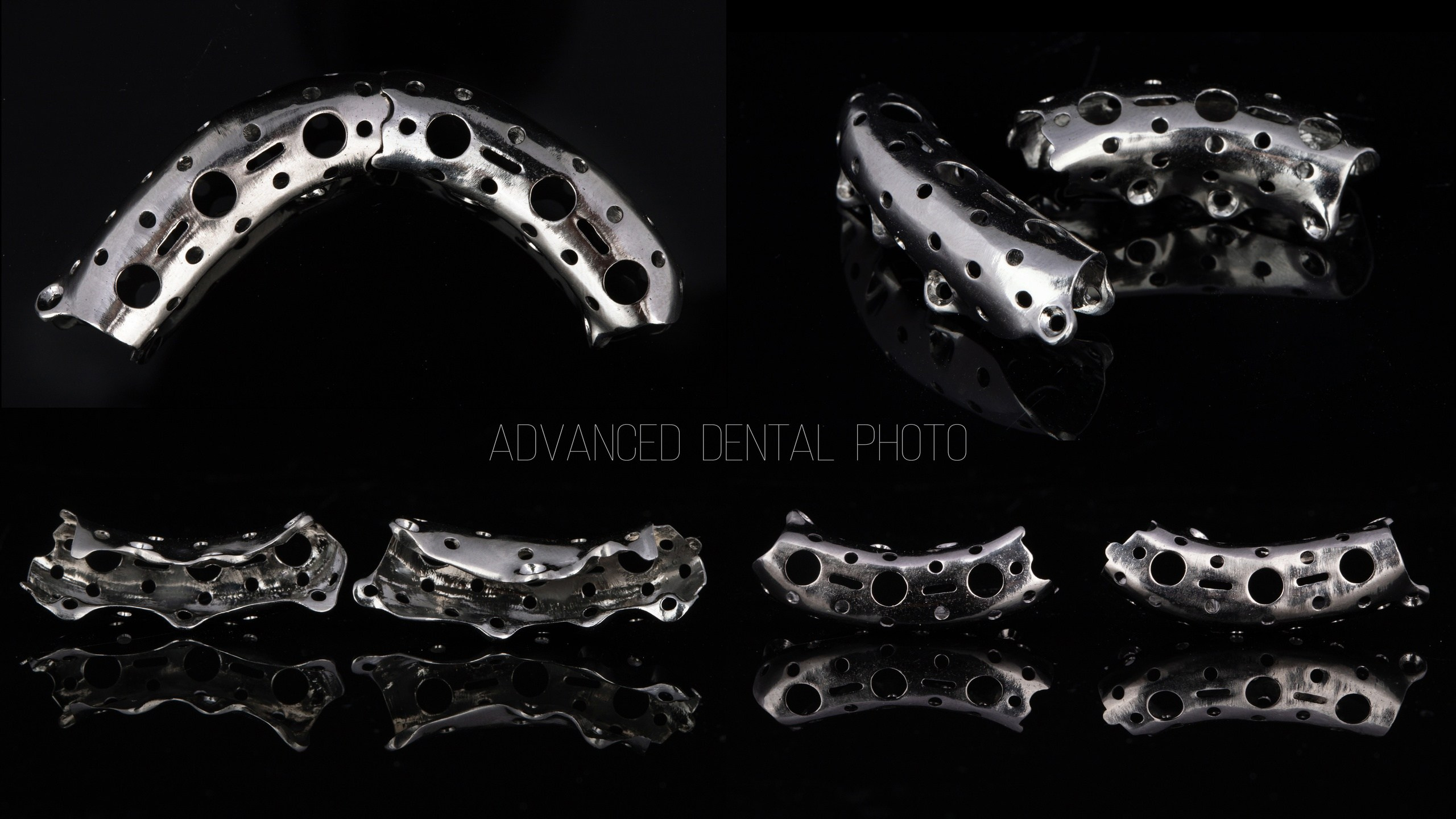 Хирургия. Дентал фотограф — видеограф Денис Дорошенко