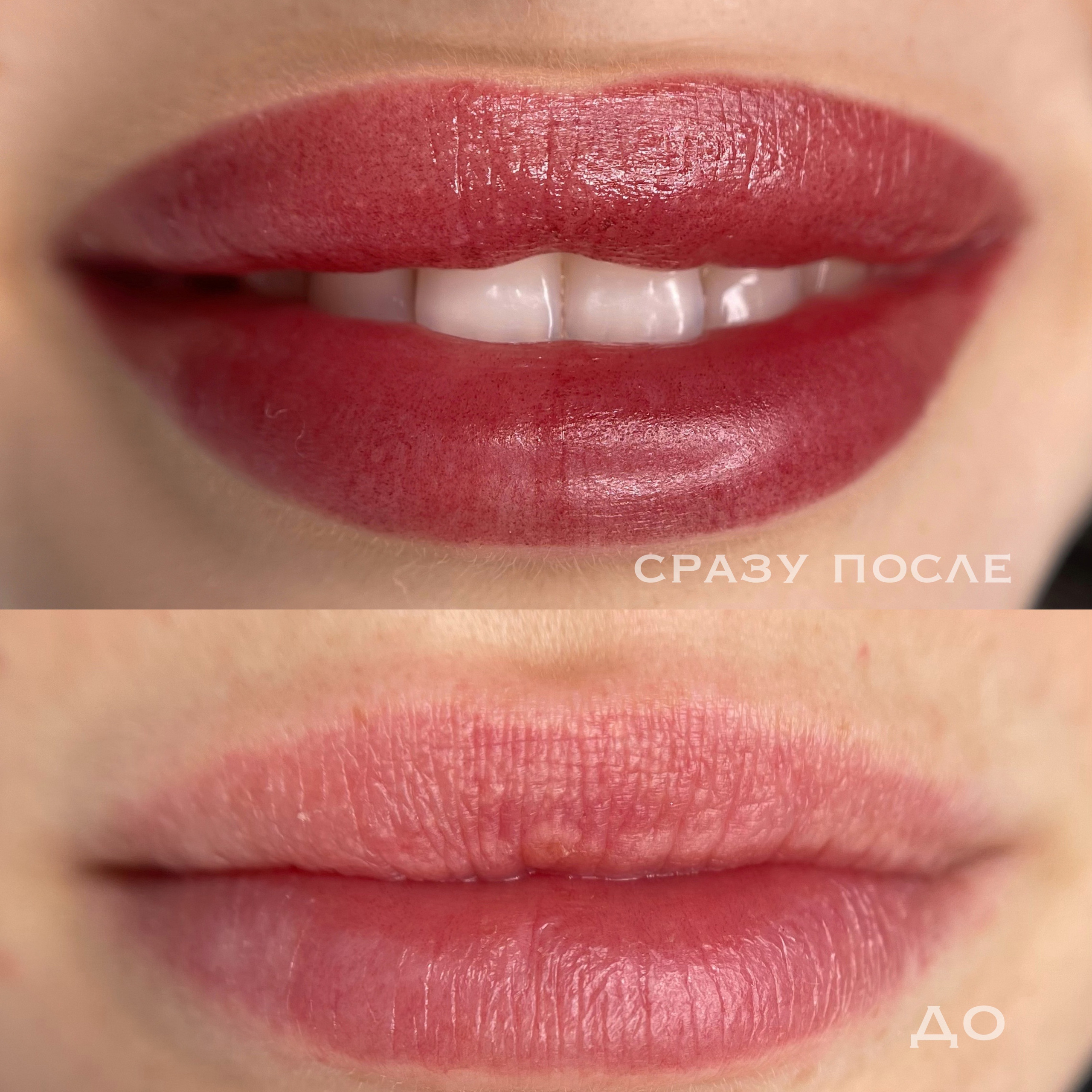 ГУБЫ сразу после процедуры. Перманентный макияж и удаление старого татуажа в Ростове-на-Дону Дарья Исакова