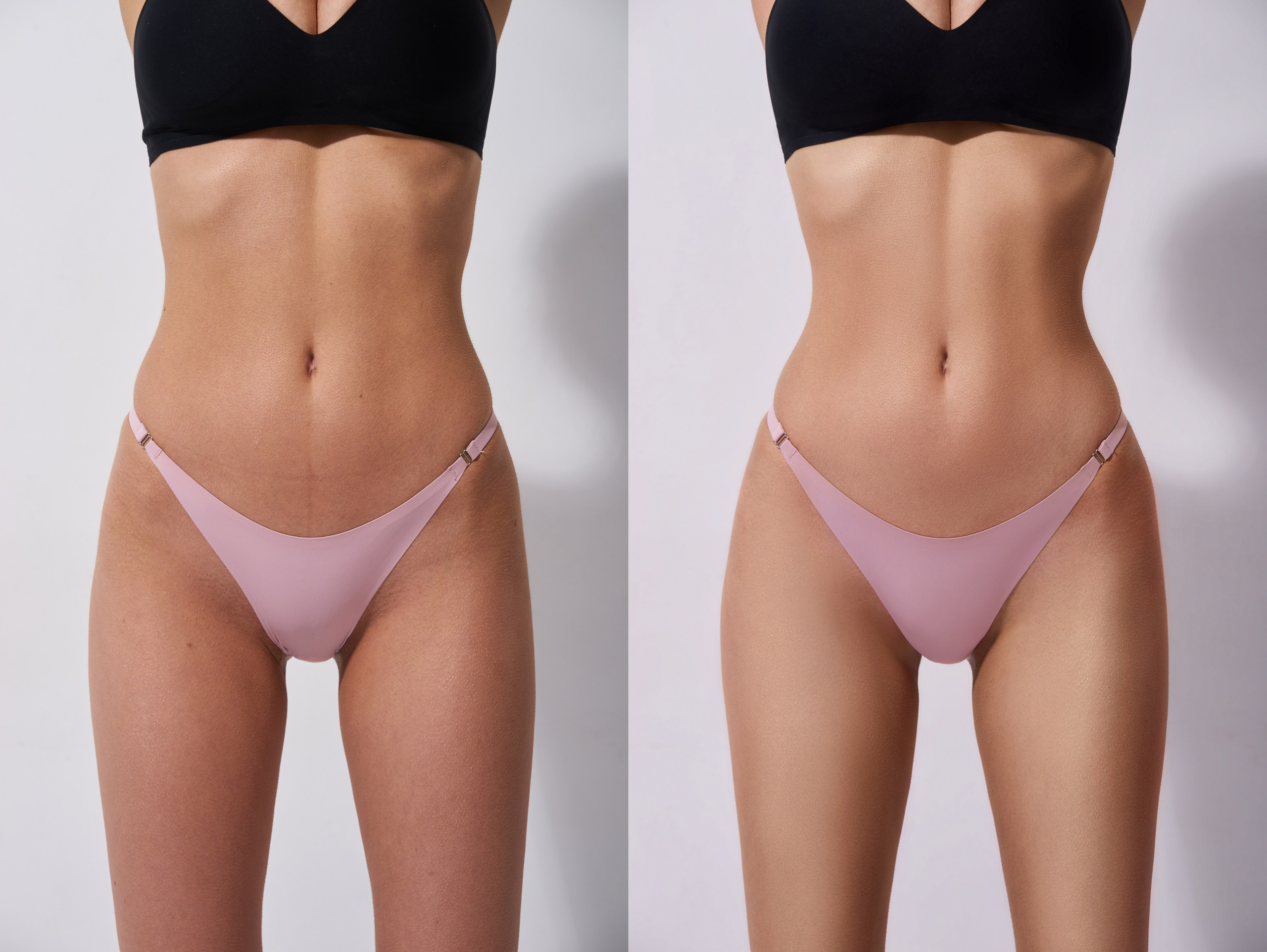 Деликатная обработка портретов для рекламы нижнего белья | Студия SVITHART