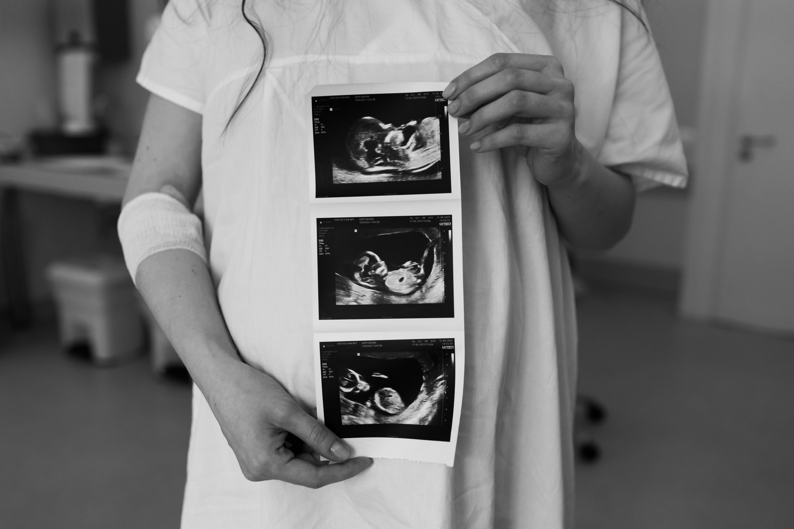 Рождение Вовы. Фотограф на роды в Санкт-Петербурге Екатерина Сысоева