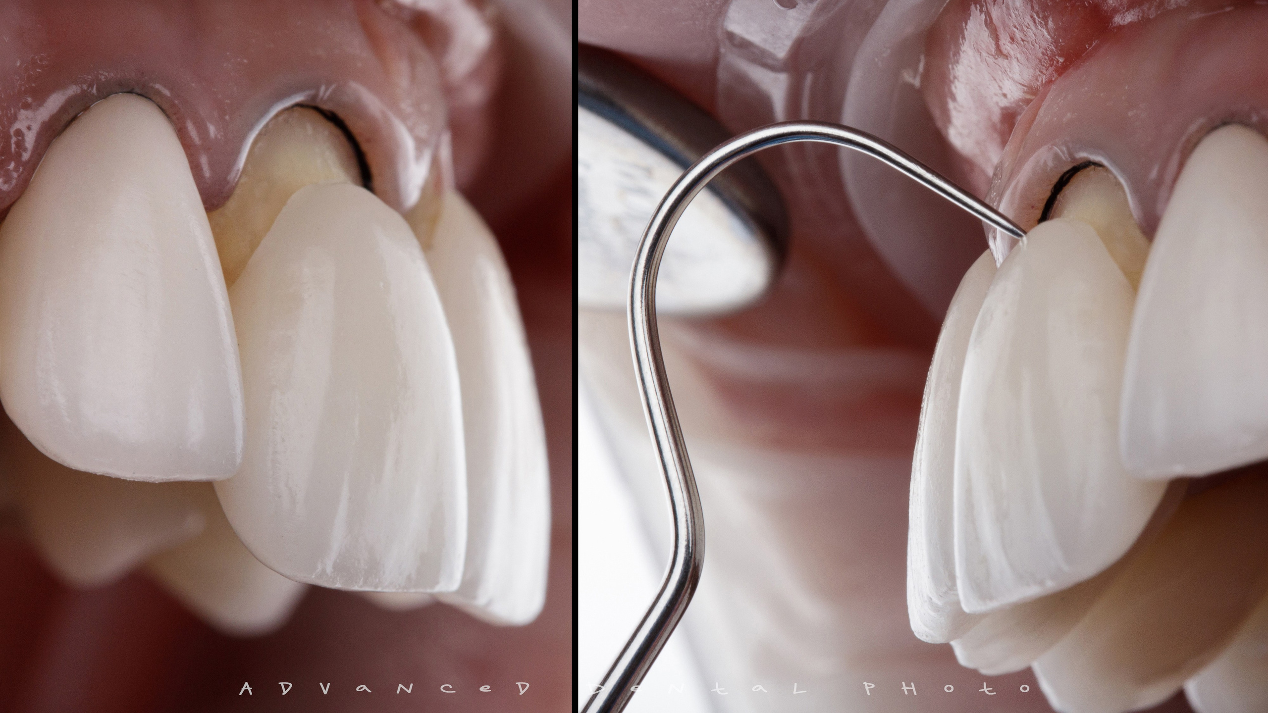 Ортопедия. Дентал фотограф — видеограф Денис Дорошенко