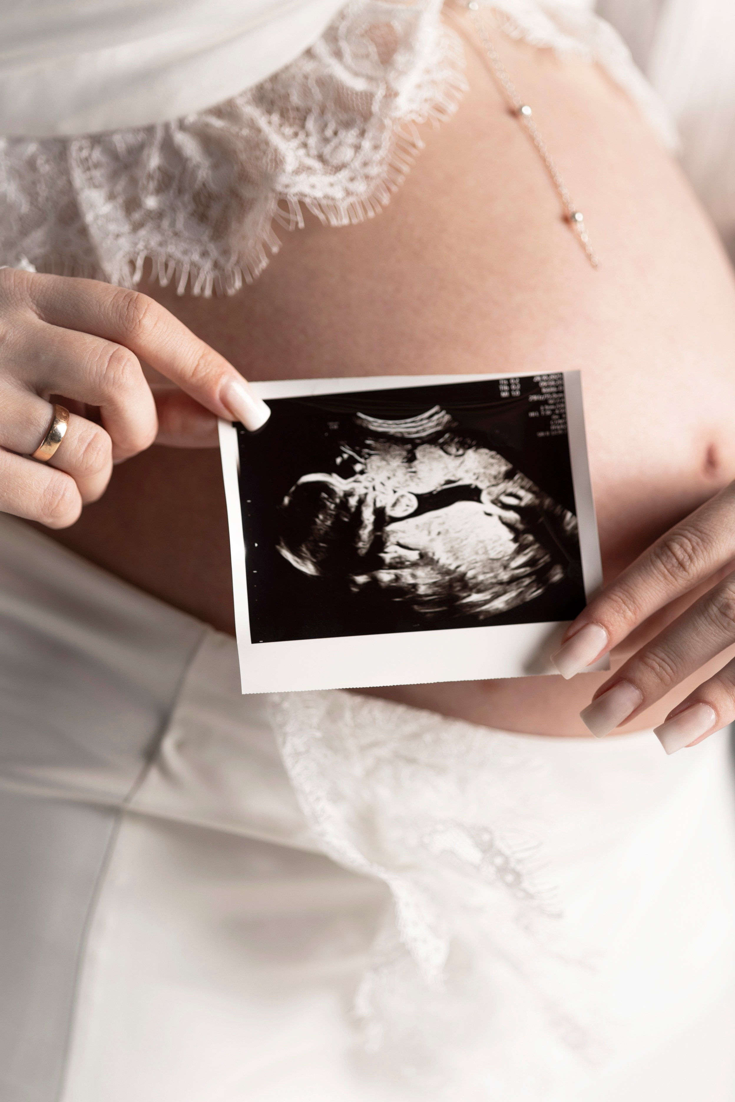 Алёна. YANA KIDVSKAT