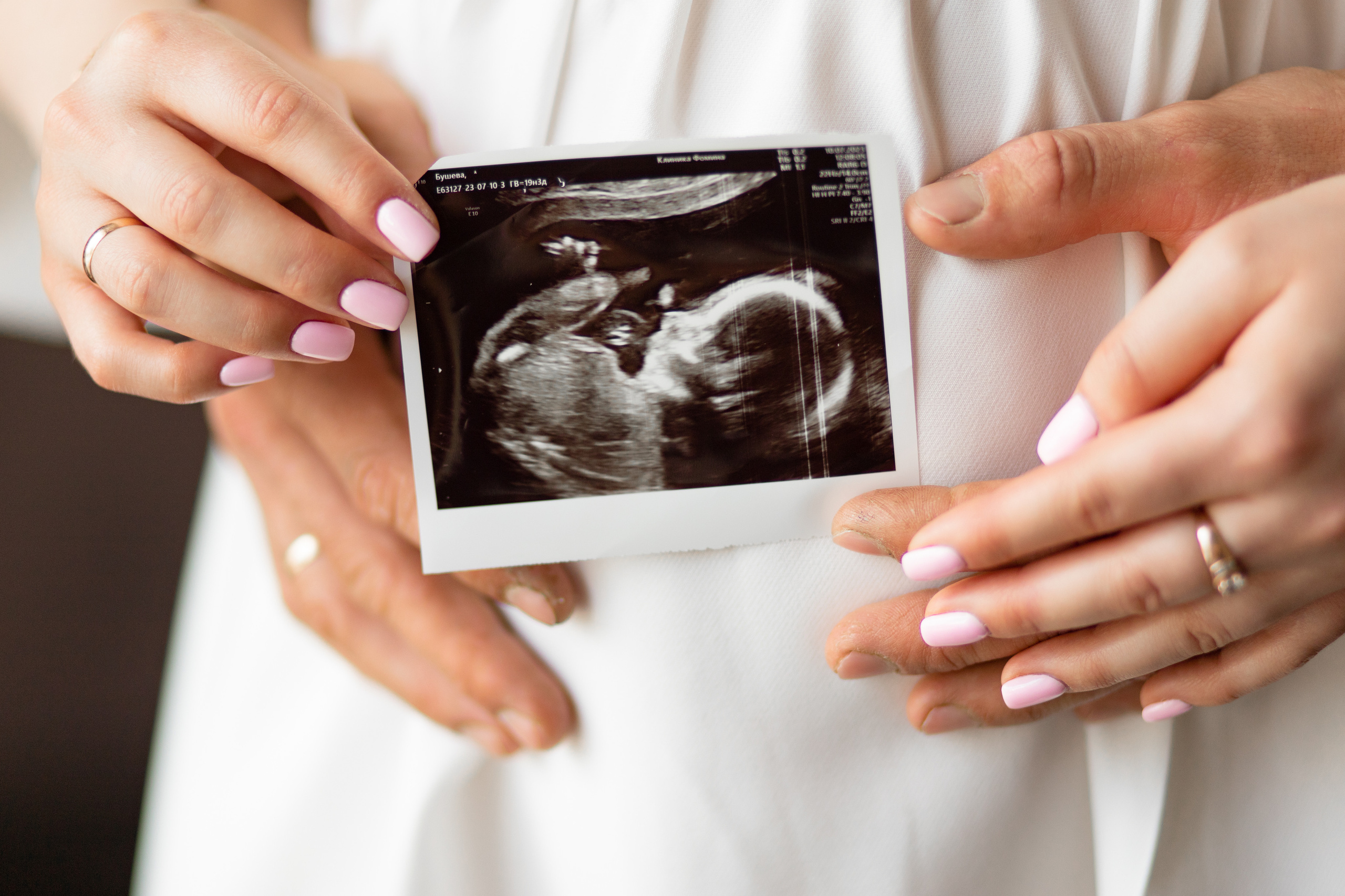 В зале Карамель. Фотограф Белгород