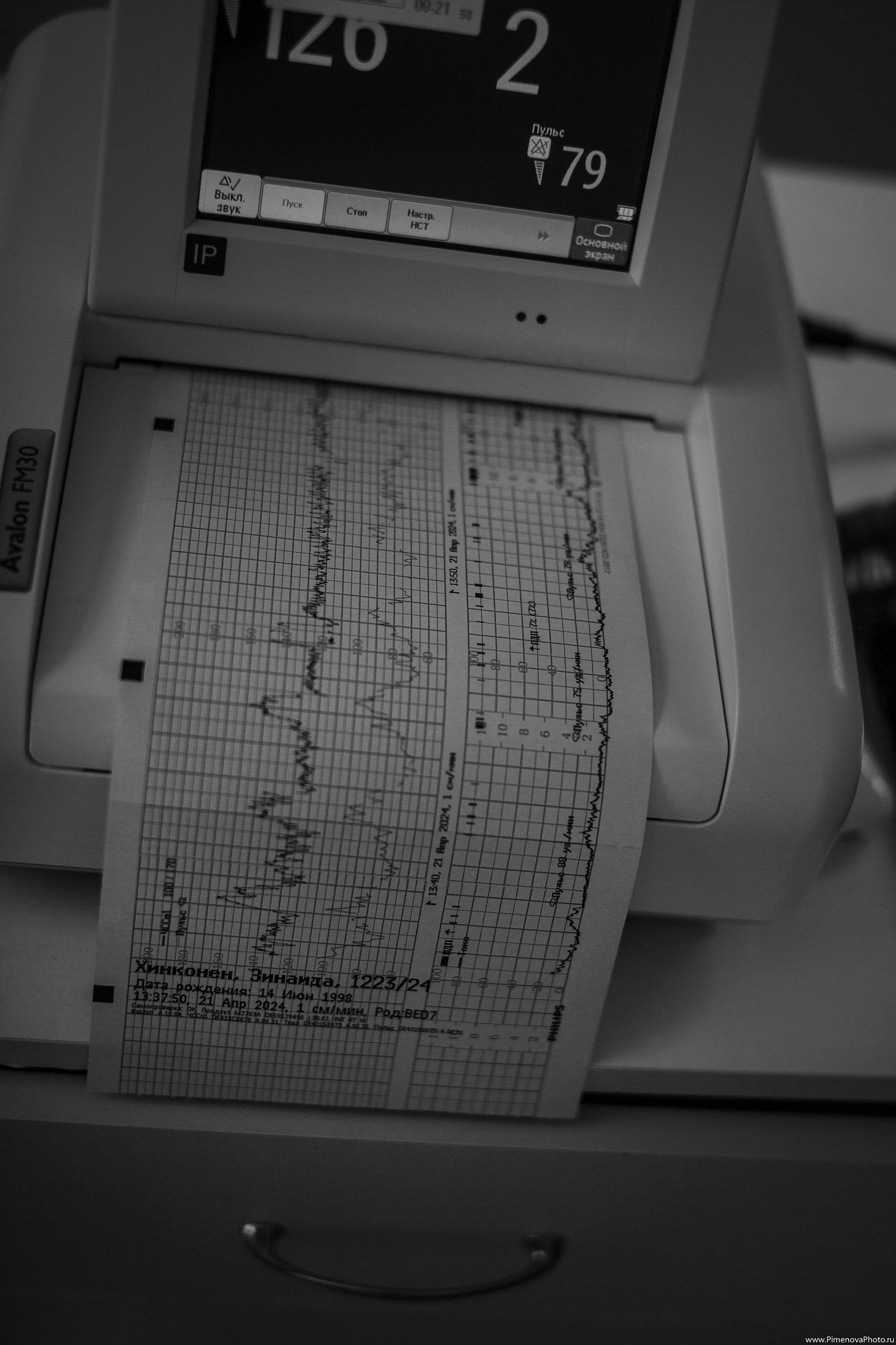 Естественные Роды. Семейный и детский фотограф в Петрозаводске