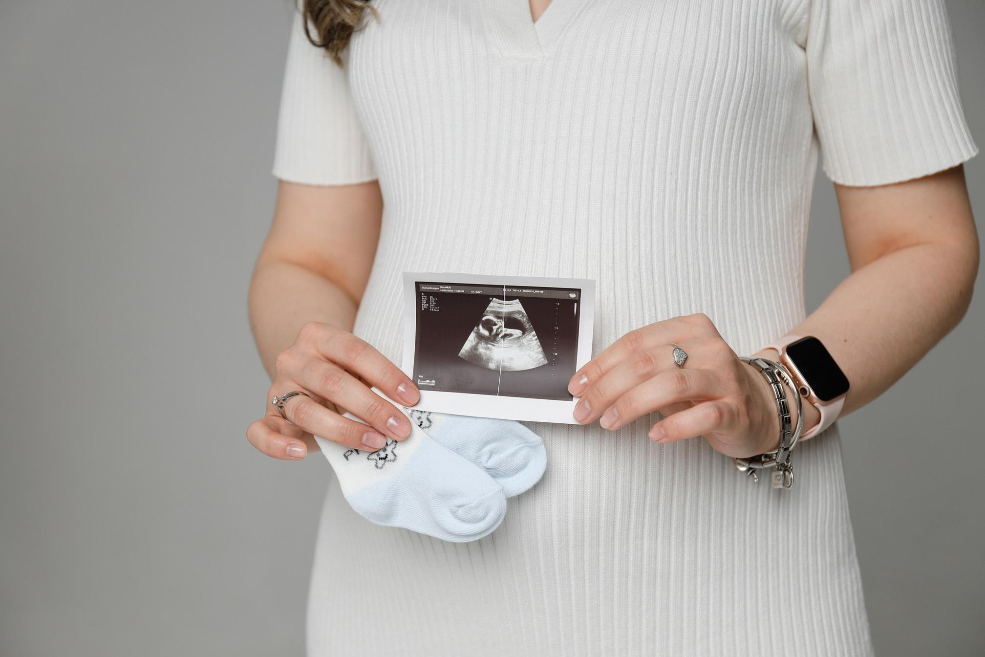 В ожидании чуда. Алина Малышева, свадебный и семейный фотограф Москва