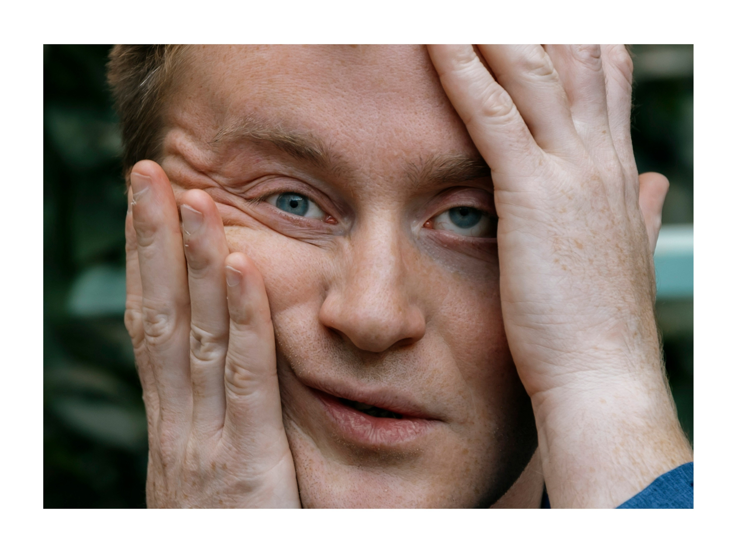 мужчина сжимает свое лицо