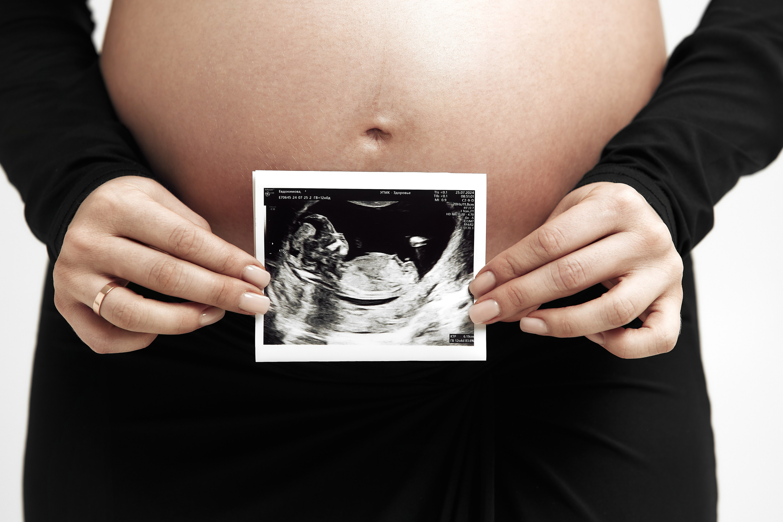 Фотосессия «В ожидании чуда» — нежные и трогательные моменты от профессионального фотографа. Дмитрий Мазуркевич: Профессиональный Репортажный Фотограф