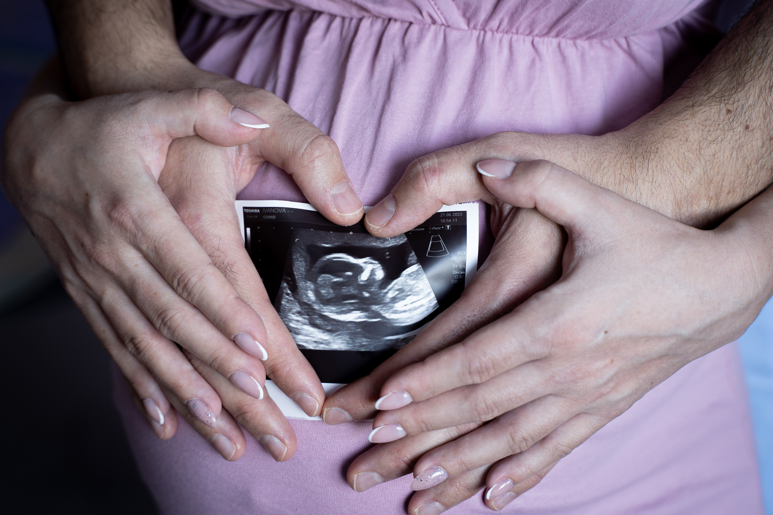 Валерия. Фотограф на роды Москва Ольга Летучева